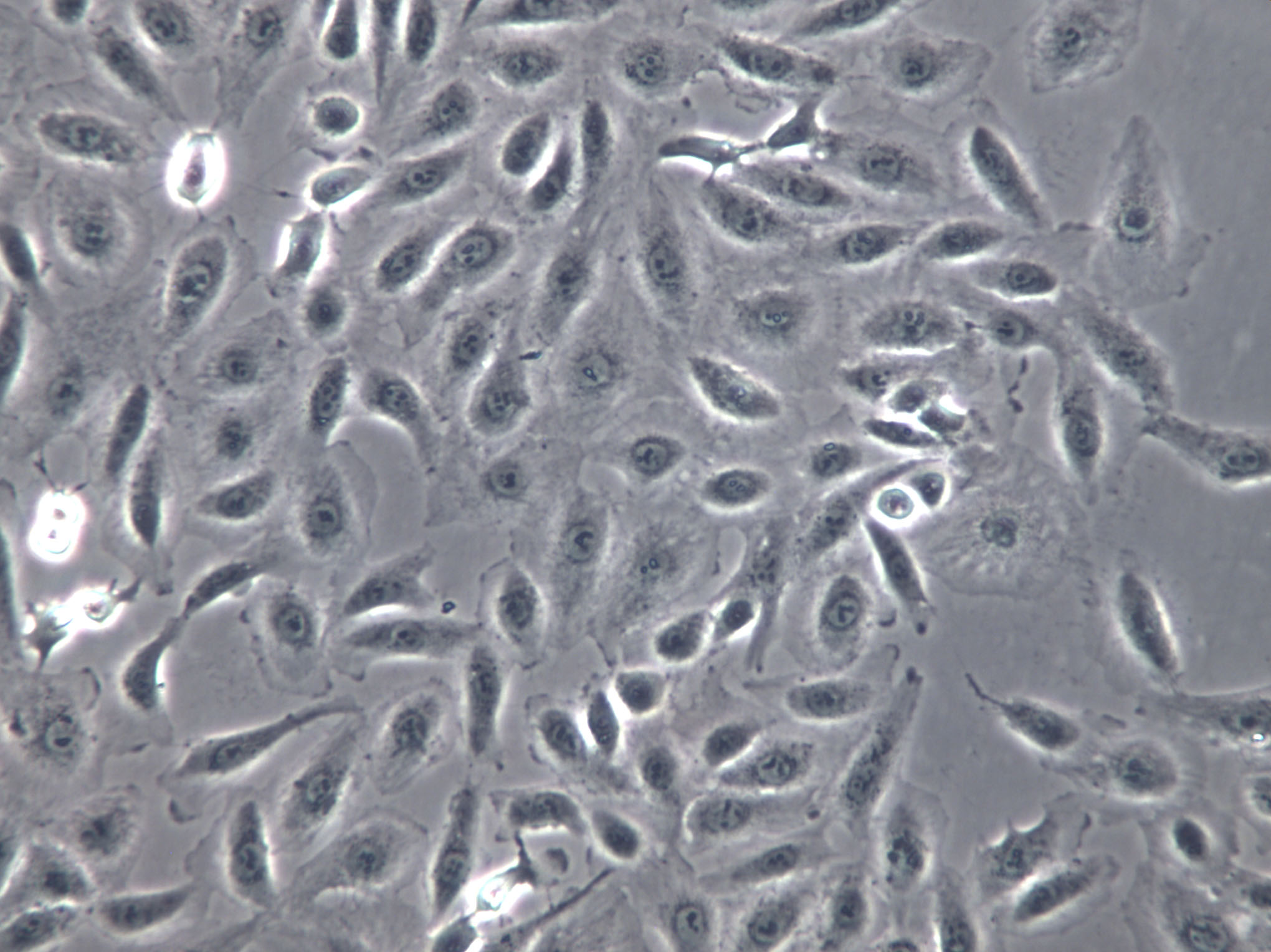 HCC9724 Cells(赠送Str鉴定报告)|人肝癌细胞