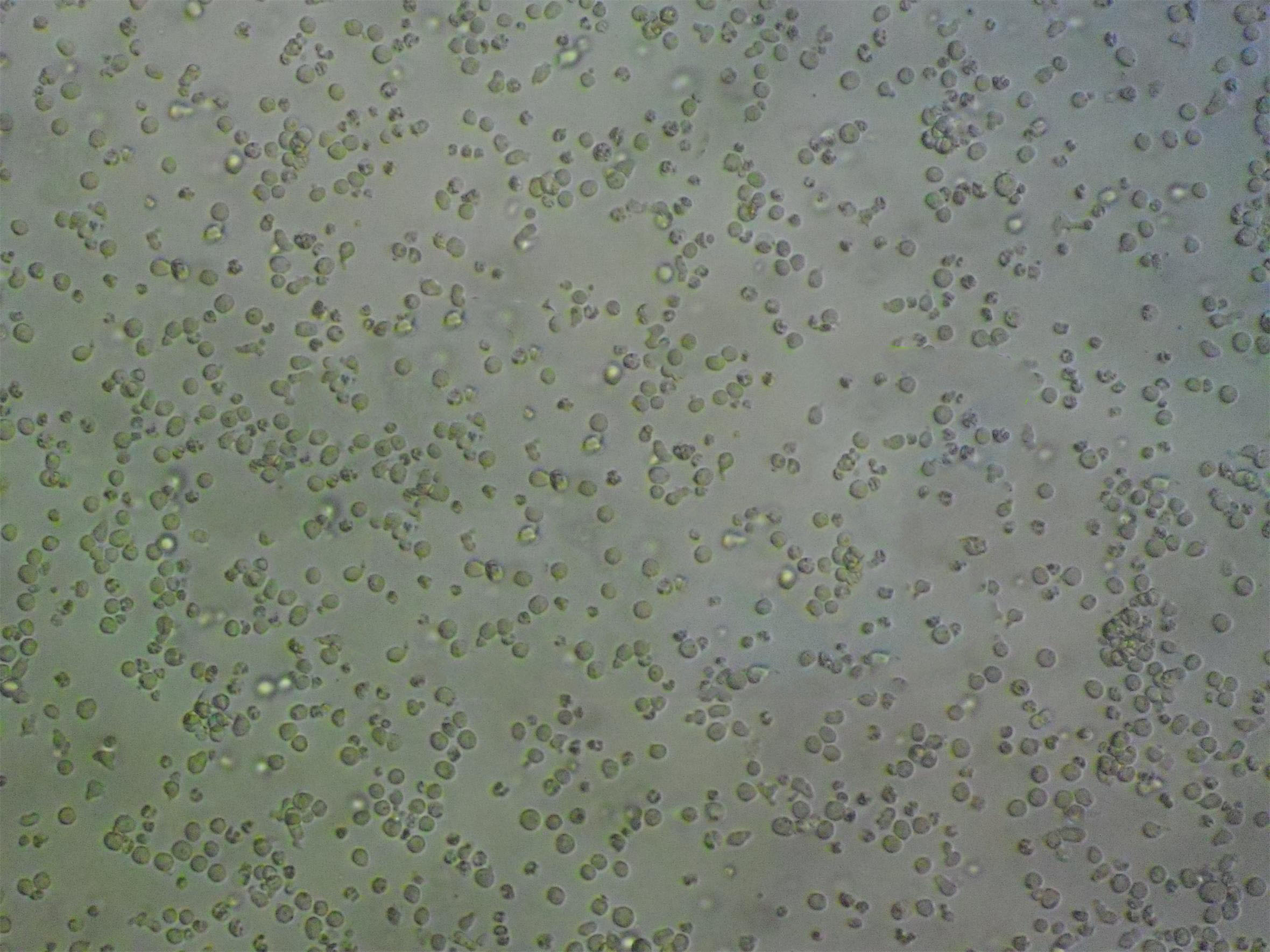 Raji Cells|人Burkitt’s淋巴瘤克隆细胞(包送STR鉴定报告)