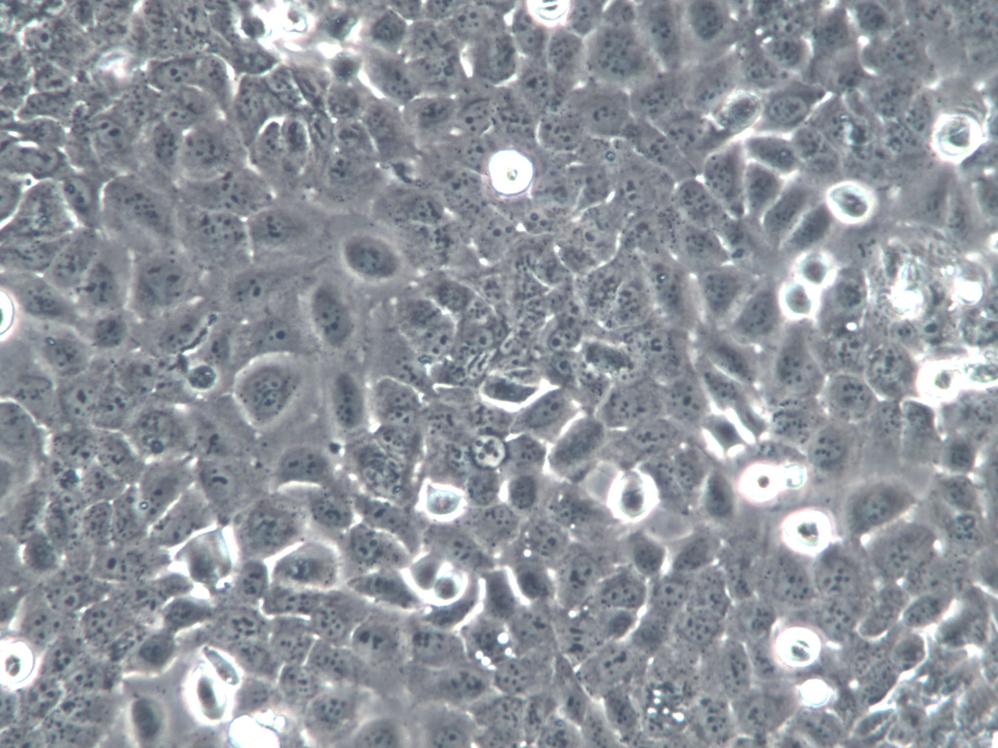 NCI-H2122 Cells|人肺癌克隆细胞(包送STR鉴定报告)ells|人支气管肺泡腺癌克隆细胞(包送STR鉴定报告)