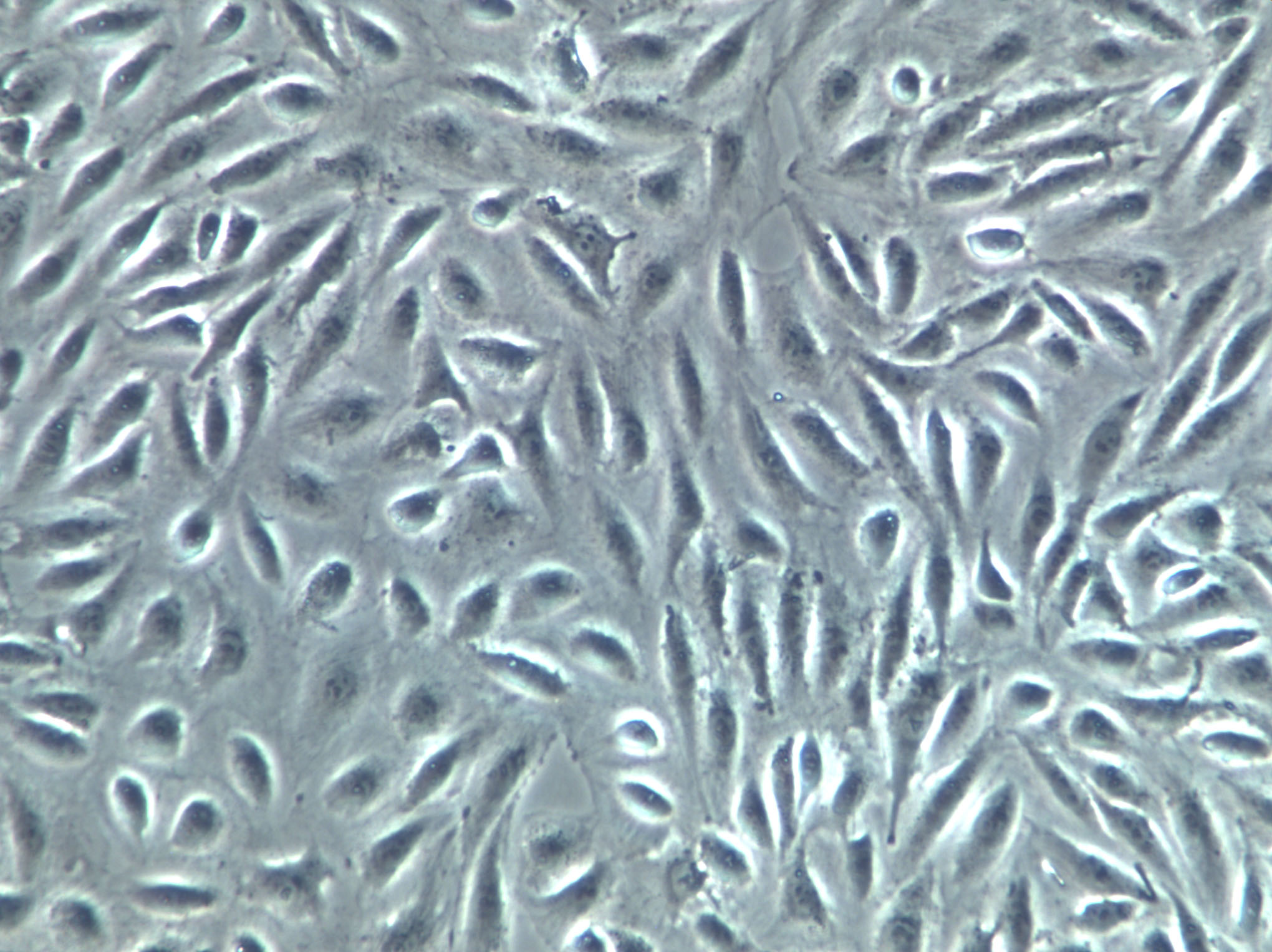 NCI-H650 Cells|人非小细胞肺癌克隆细胞(包送STR鉴定报告)