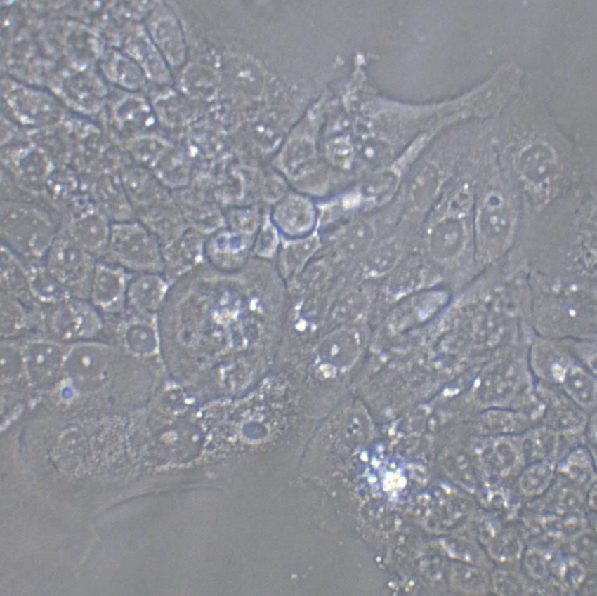 NCI-H1836 Cells|人小细胞肺癌克隆细胞(包送STR鉴定报告)