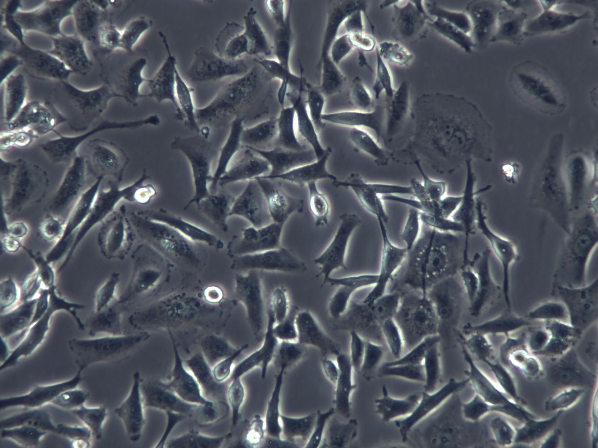 COV504 Cells|人卵巢癌克隆细胞