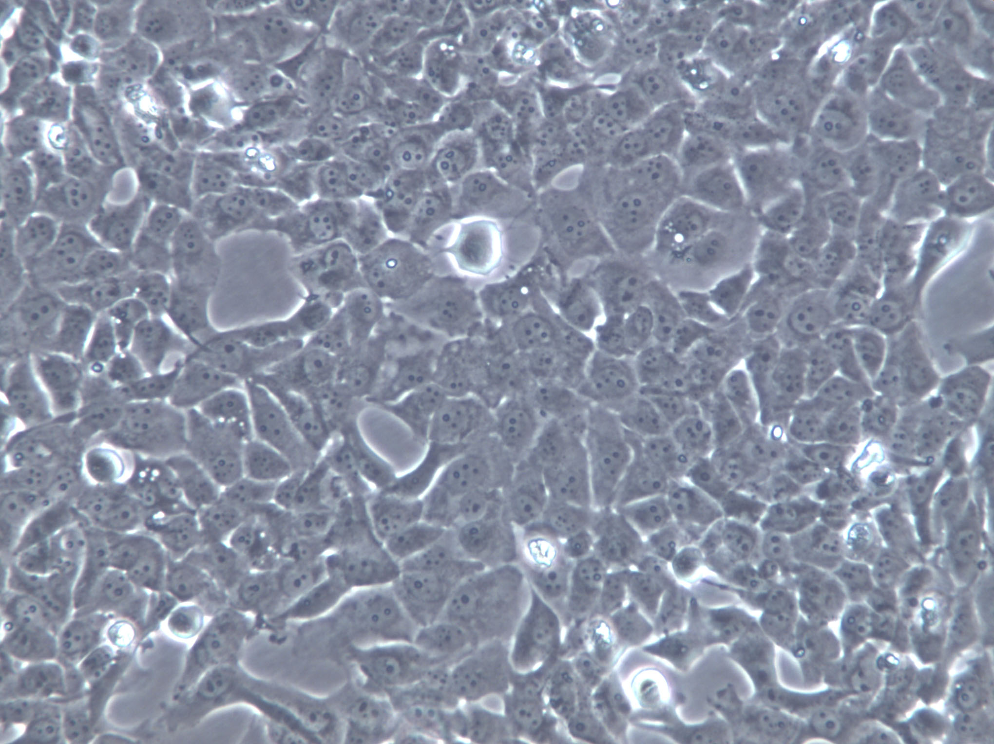 BT-325 Cells(赠送Str鉴定报告)|人脑多型胶质母细胞