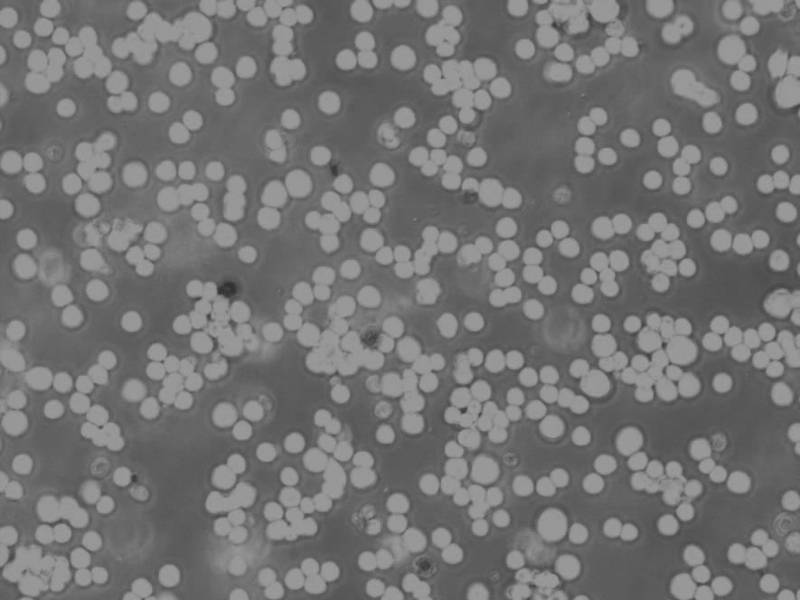 CCRF-CEM Cells|人急性淋巴细胞白血病T淋巴克隆细胞(包送STR鉴定报告)