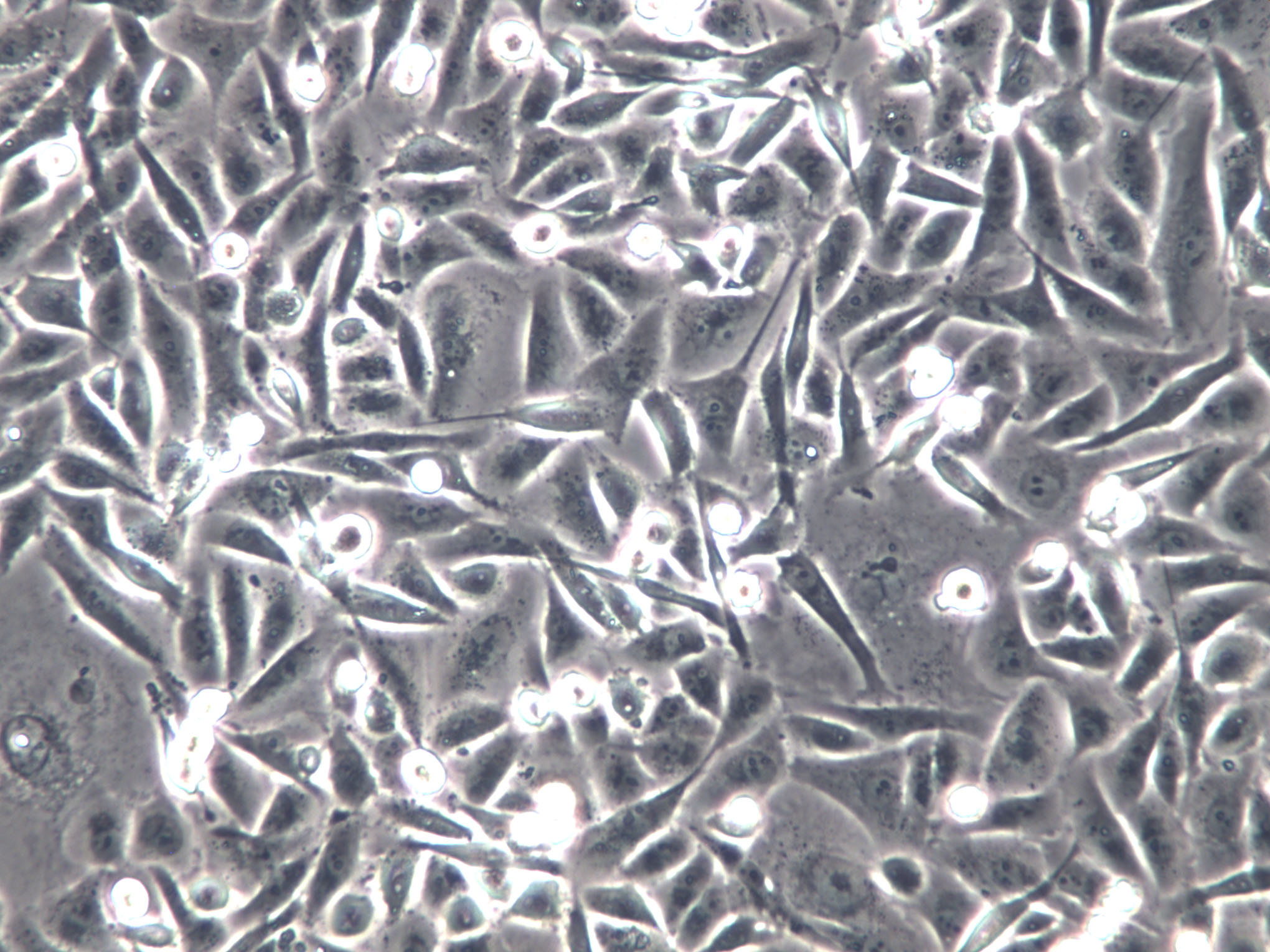 CMT167 Cells(赠送Str鉴定报告)|小鼠肺癌细胞