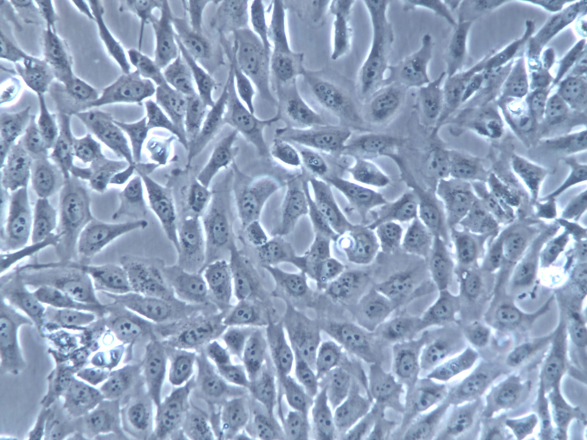 FET Cells(赠送Str鉴定报告)|人结肠癌细胞