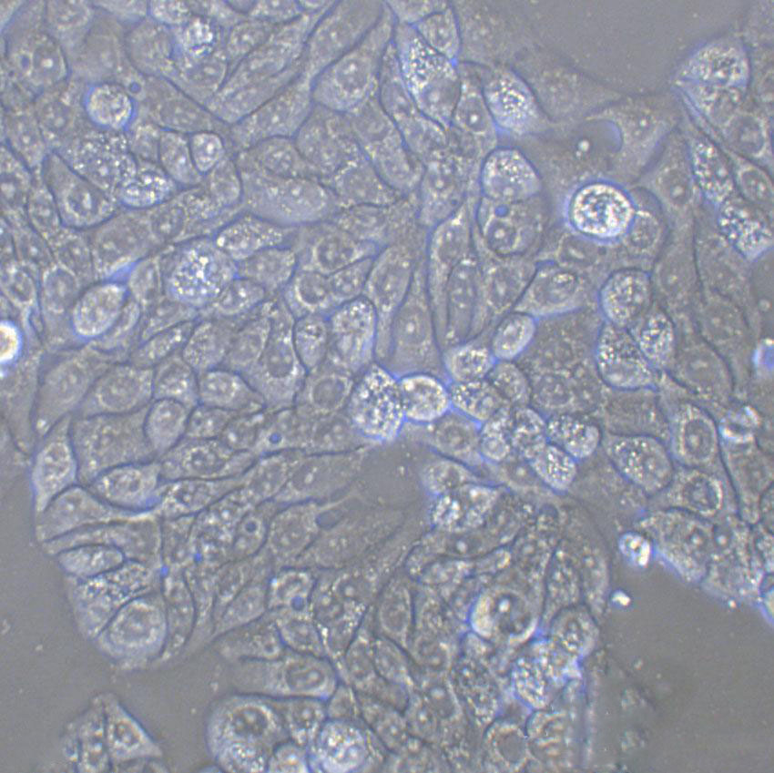 MC57G Cells(赠送Str鉴定报告)|小鼠纤维肉瘤细胞