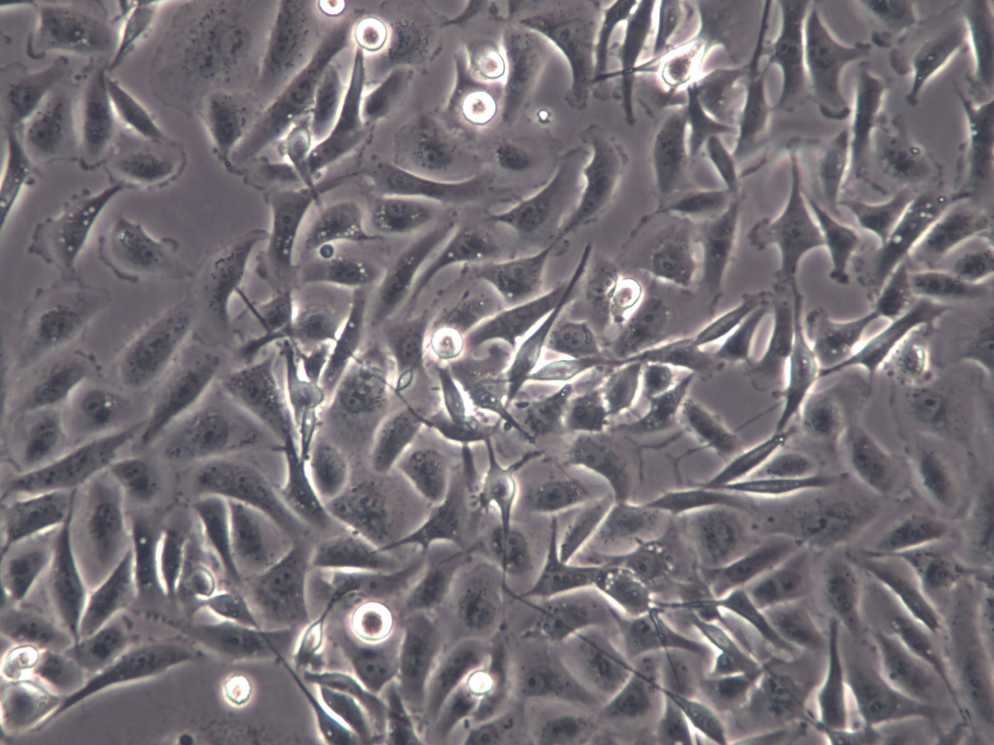 MCF-7B Cells(赠送Str鉴定报告)|人乳腺癌细胞