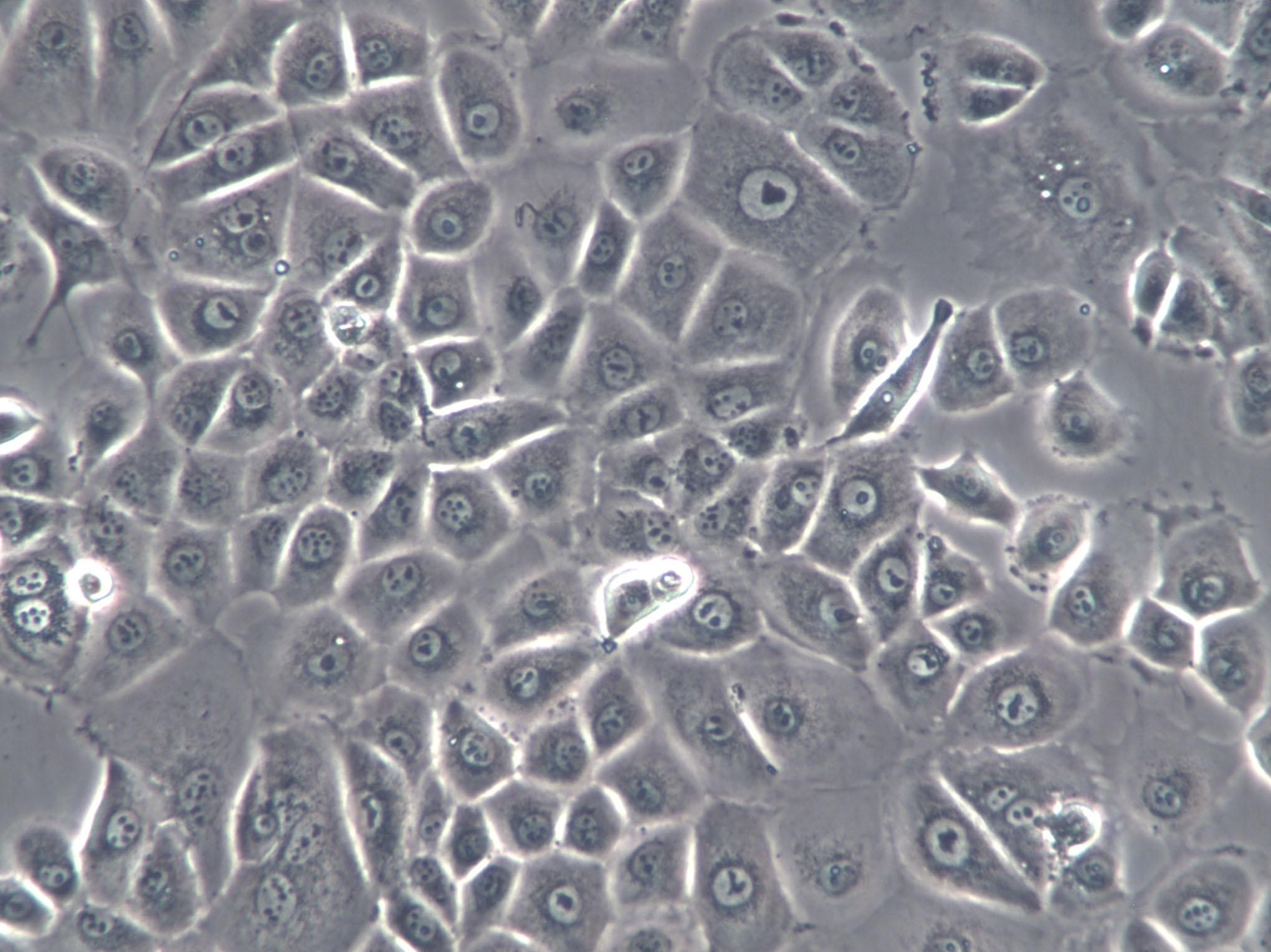 6-10B Cells(赠送Str鉴定报告)|人鼻咽癌细胞