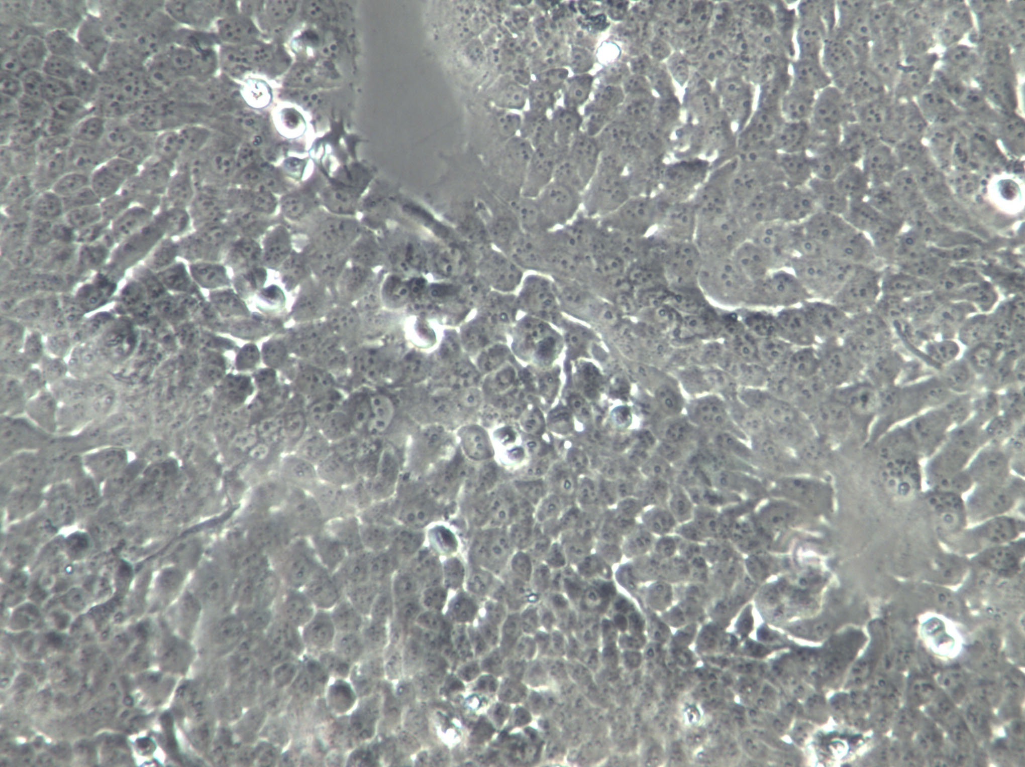 OVCAR-3 Cells|人卵巢腺癌克隆细胞