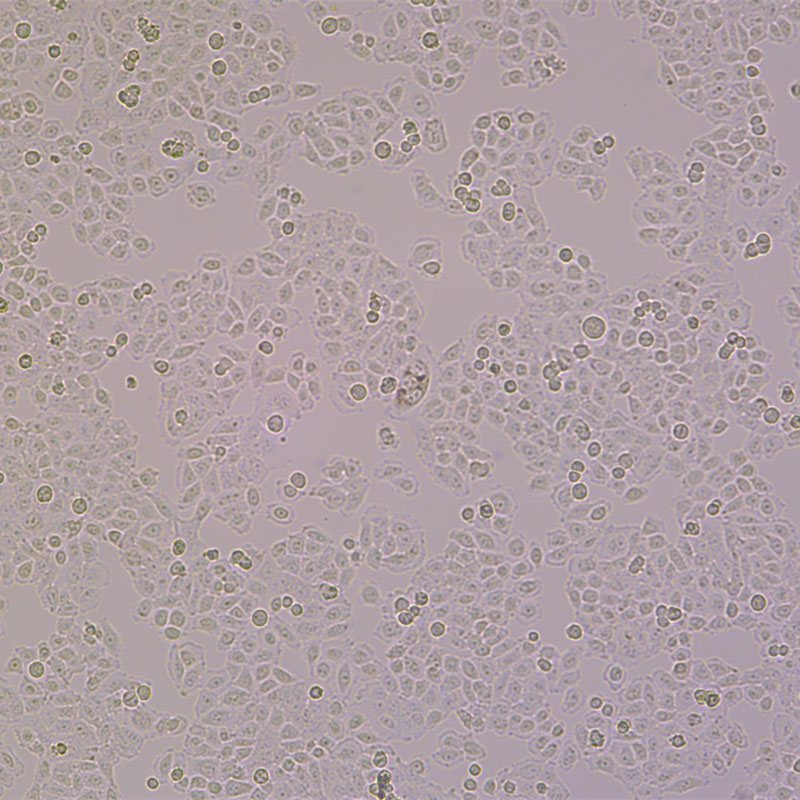BGC-823（人胃腺癌细胞（低分化））