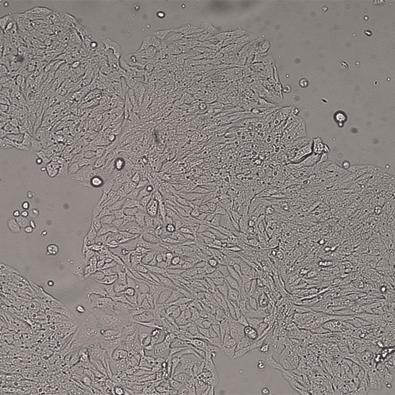 SW480人结肠腺癌细胞