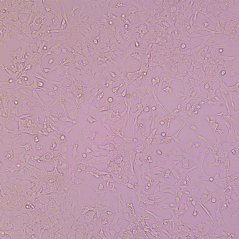 GL261（小鼠胶质瘤细胞）
