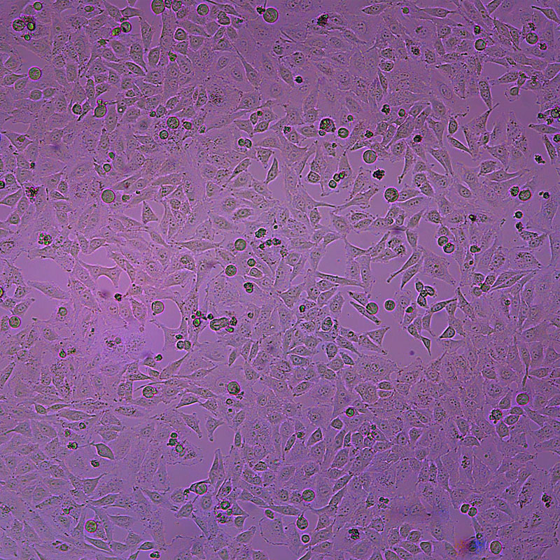 HeLa人宫颈癌细胞
