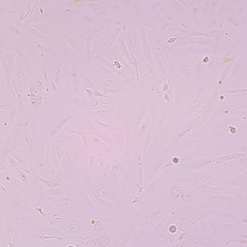 SW1353人软骨肉瘤细胞