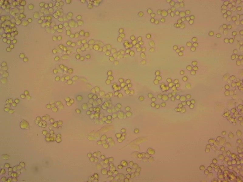 OCI-AML-3 Cells|人急性髓细胞性白血病克隆细胞(包送STR鉴定报告)