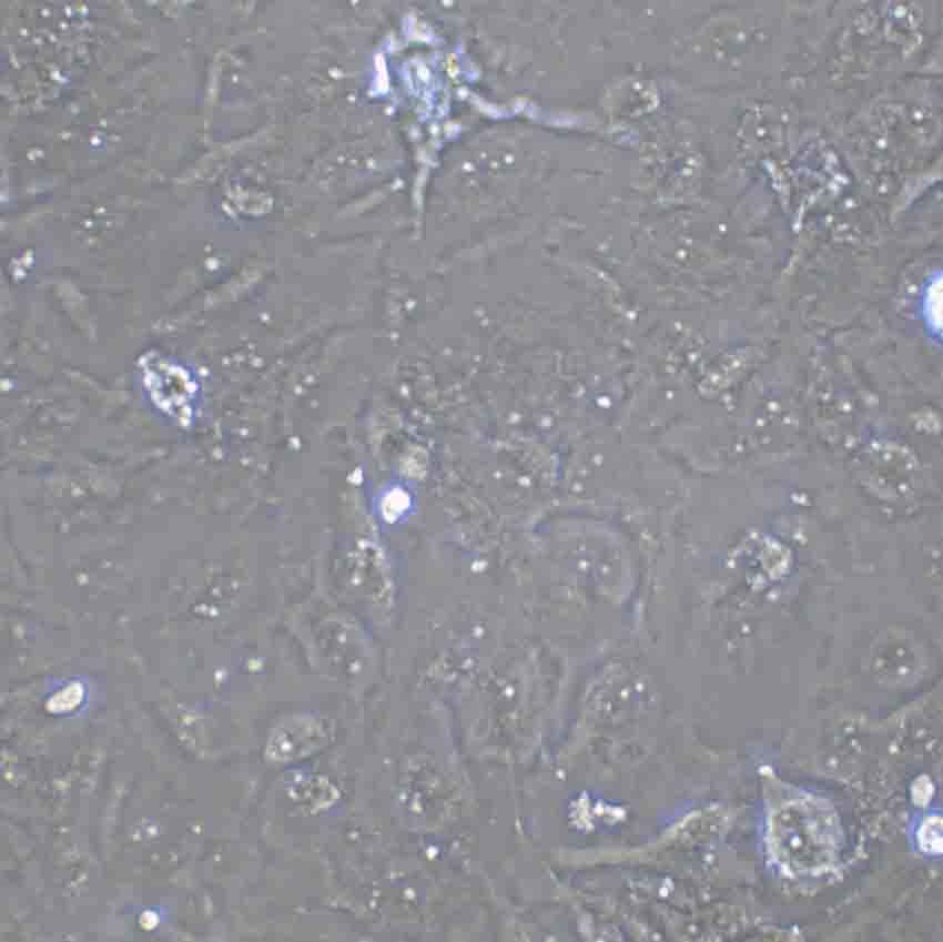 NCI-H125 Cells(赠送Str鉴定报告)|人非小细胞肺癌细胞