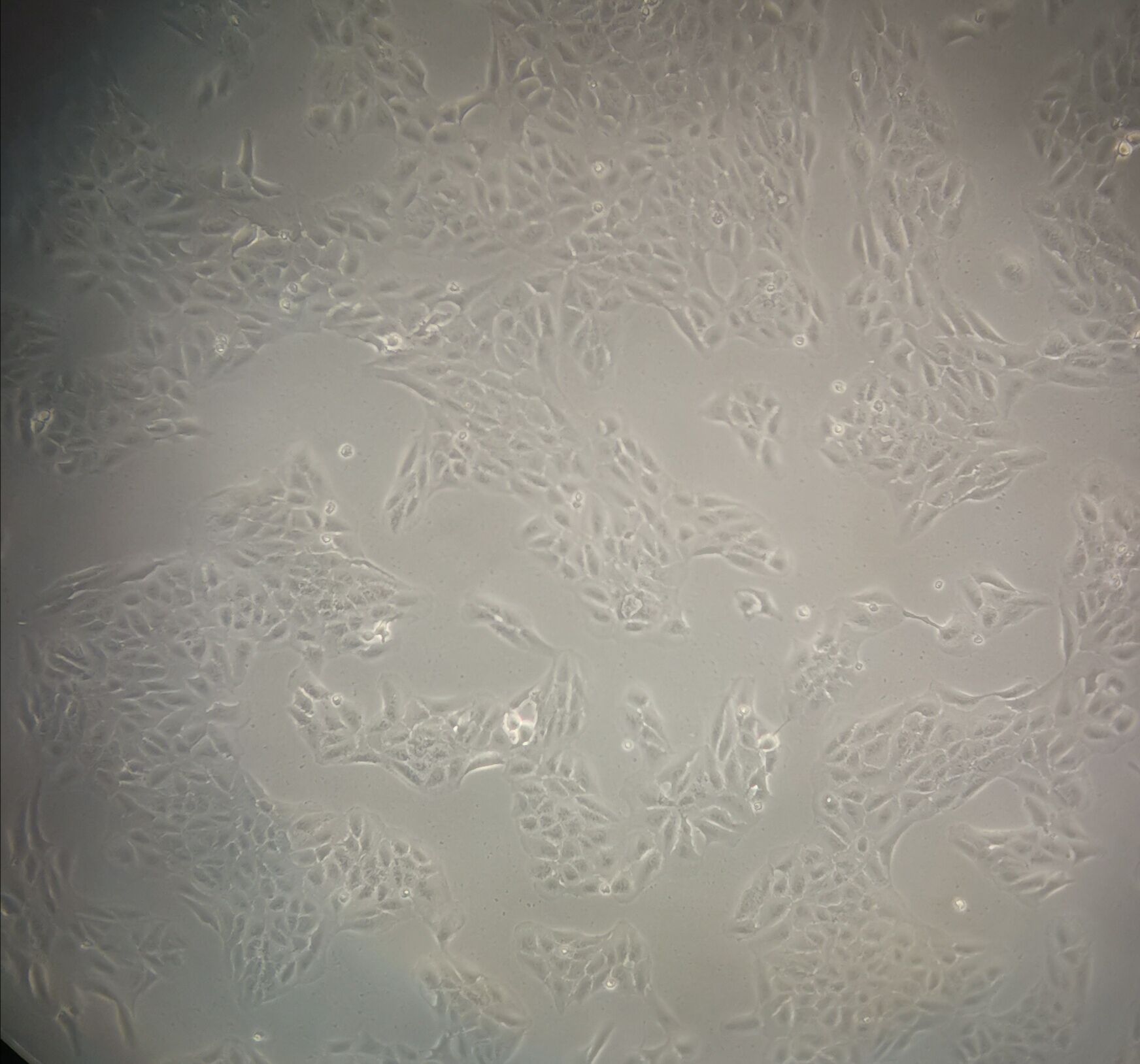 COR-L279 Cells|人肺小细胞癌克隆细胞