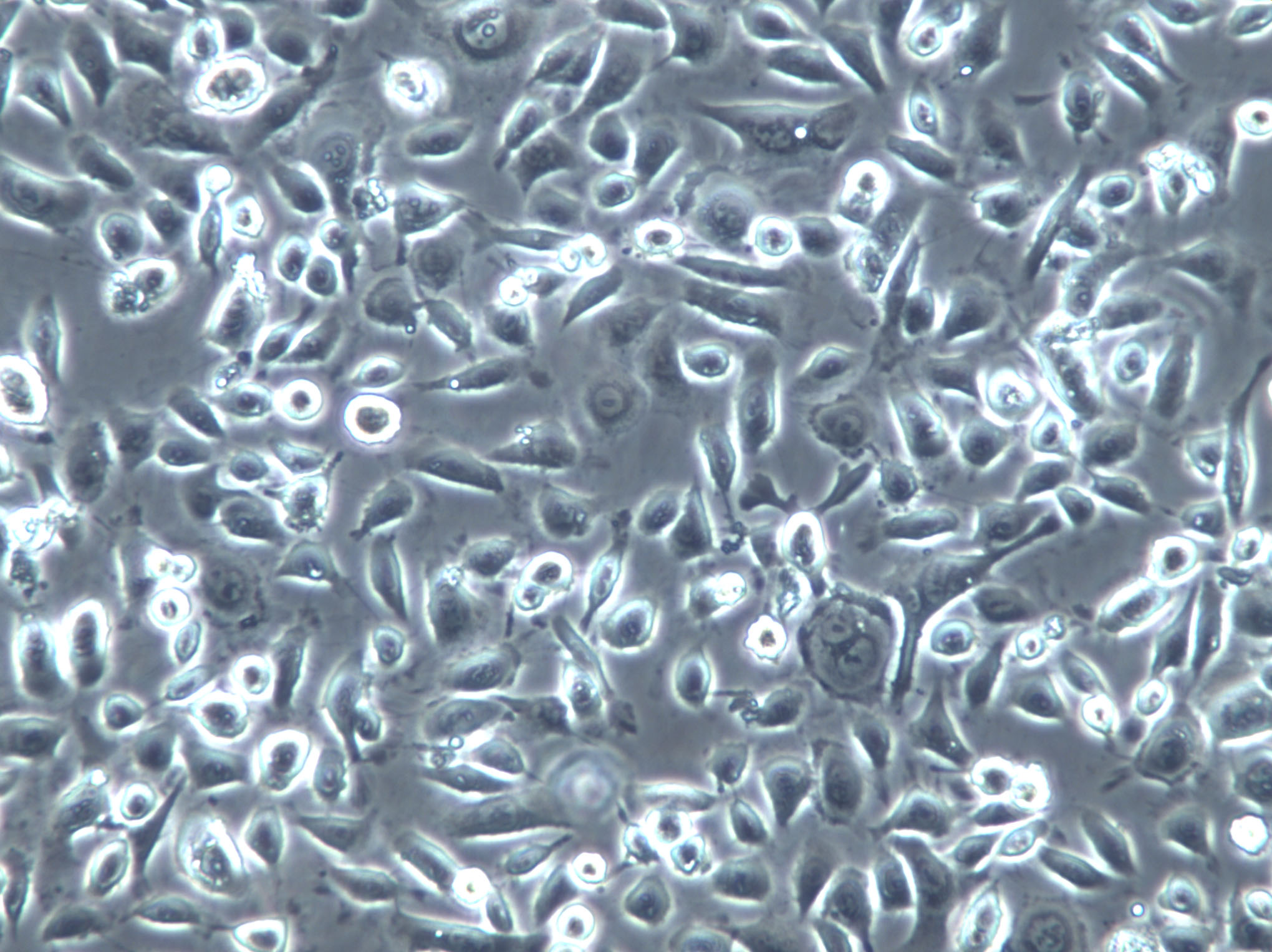HHUA Cells(赠送Str鉴定报告)|人子宫内膜癌细胞