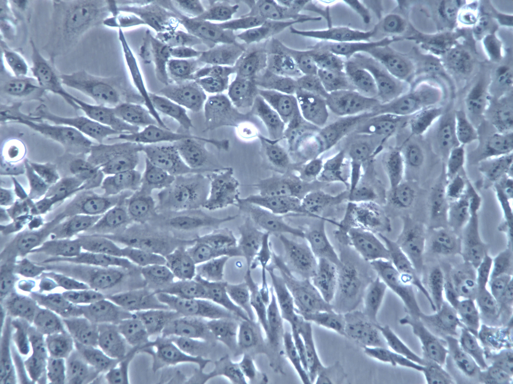 DSL-6A/C1 Cells(赠送Str鉴定报告)|大鼠胰腺癌细胞