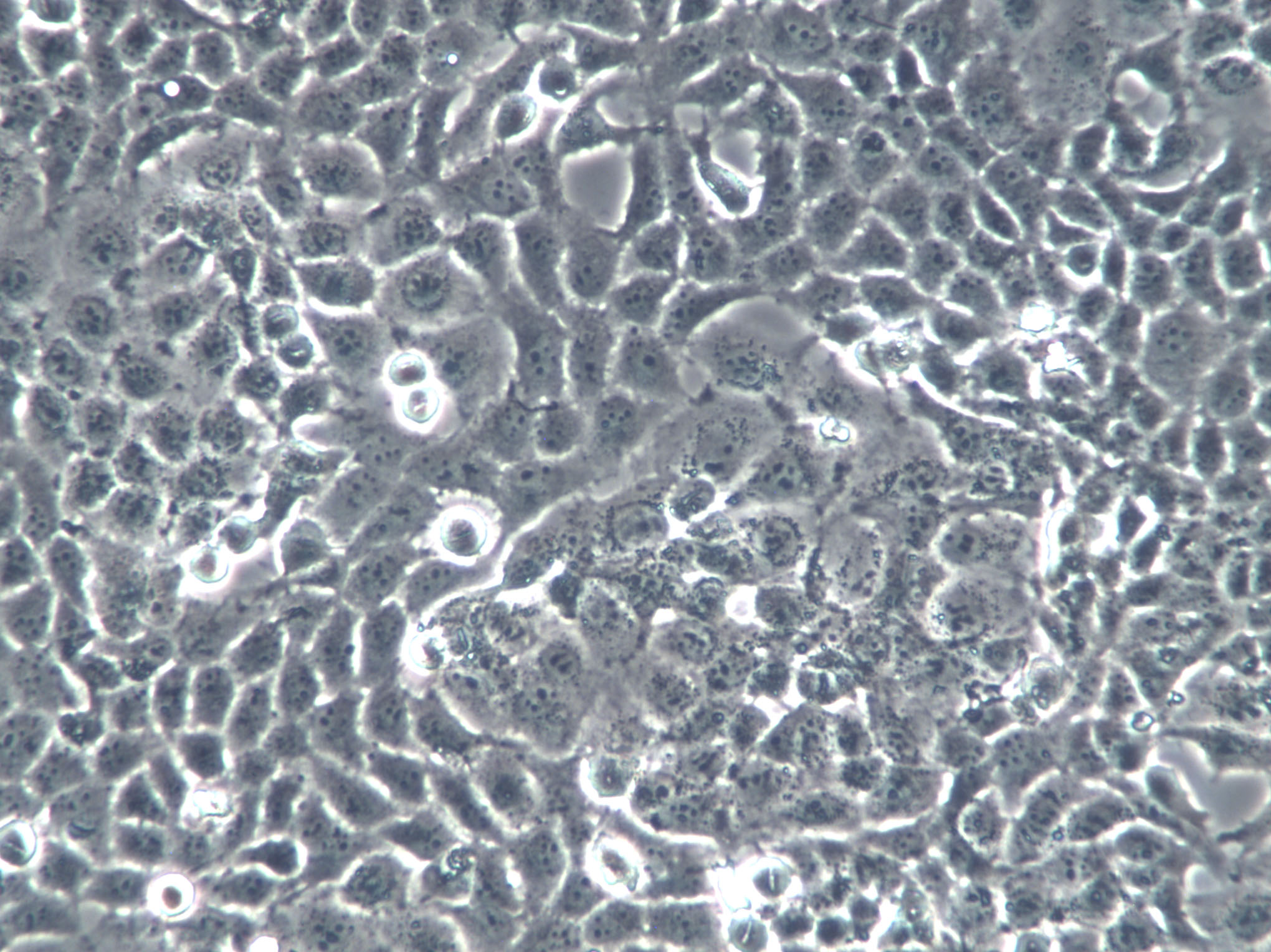 PG-BE1 Cells(赠送Str鉴定报告)|人肺巨细胞癌高转移细胞