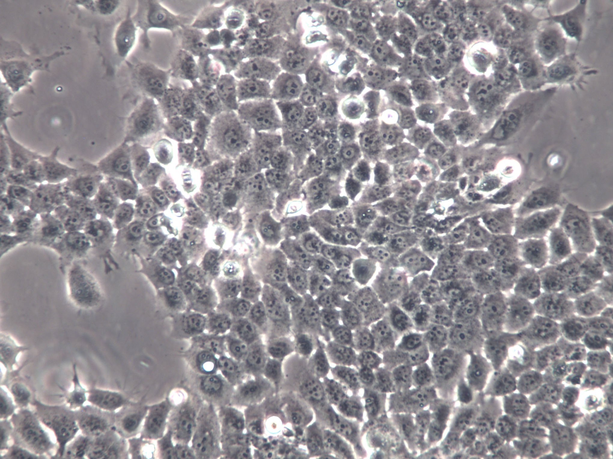 SCLC-21H Cells(赠送Str鉴定报告)|人小细胞肺癌细胞