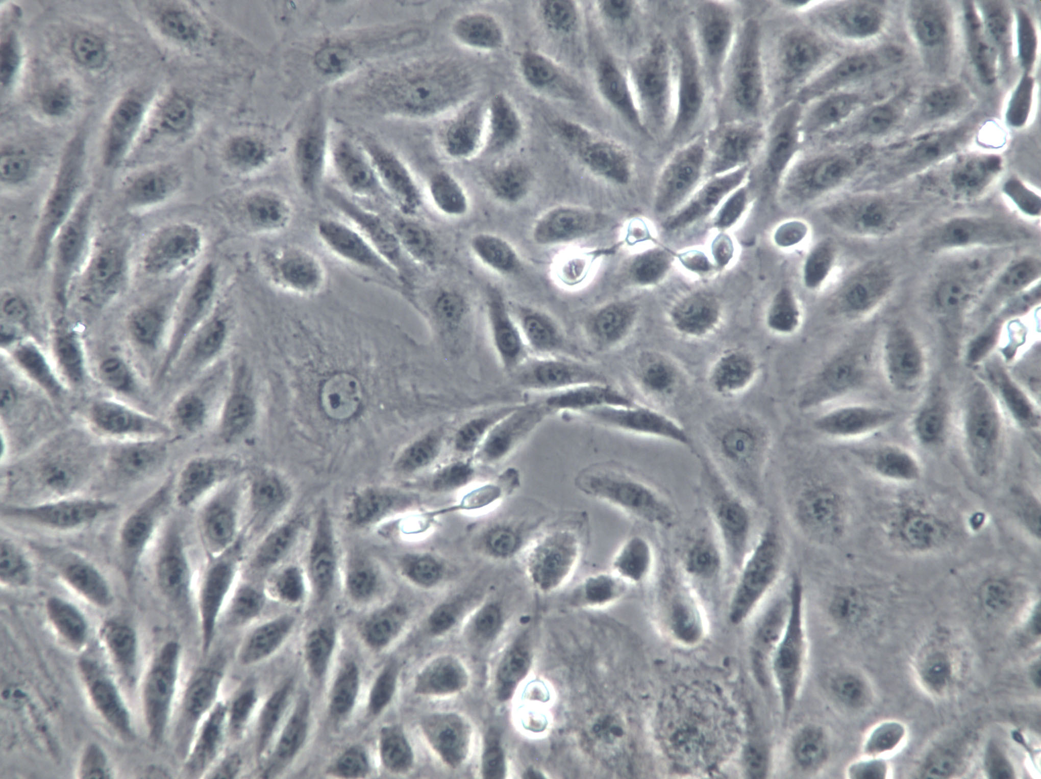 253J Cells(赠送Str鉴定报告)|人膀胱癌细胞