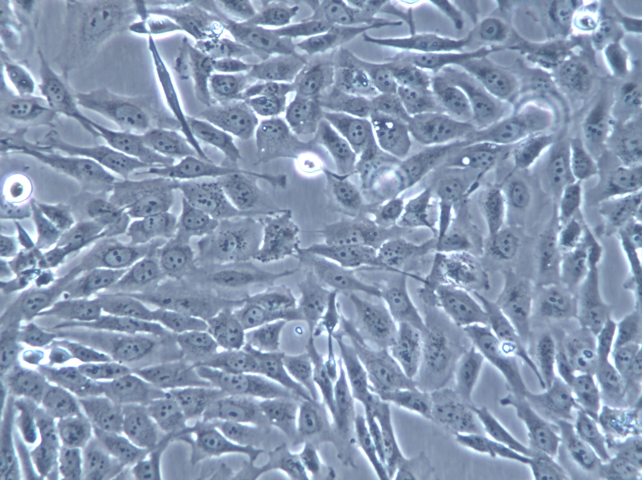 ECC-1 Cells(赠送Str鉴定报告)|人子宫内膜腺癌细胞