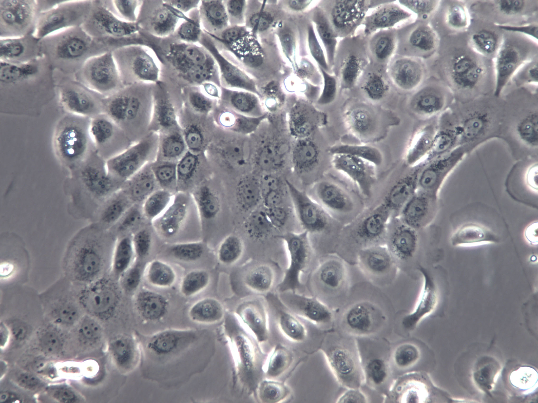 HONE-1 Cells(赠送Str鉴定报告)|人鼻咽癌细胞