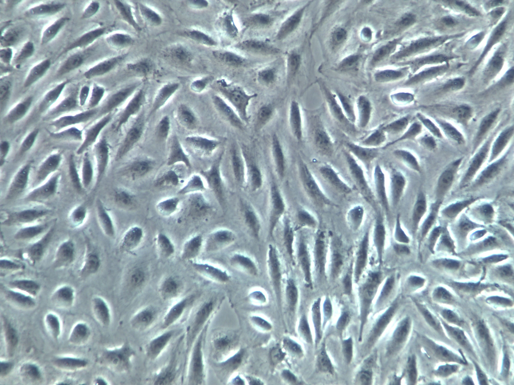 A375-SM Cells(赠送Str鉴定报告)|人恶性黑色素瘤细胞