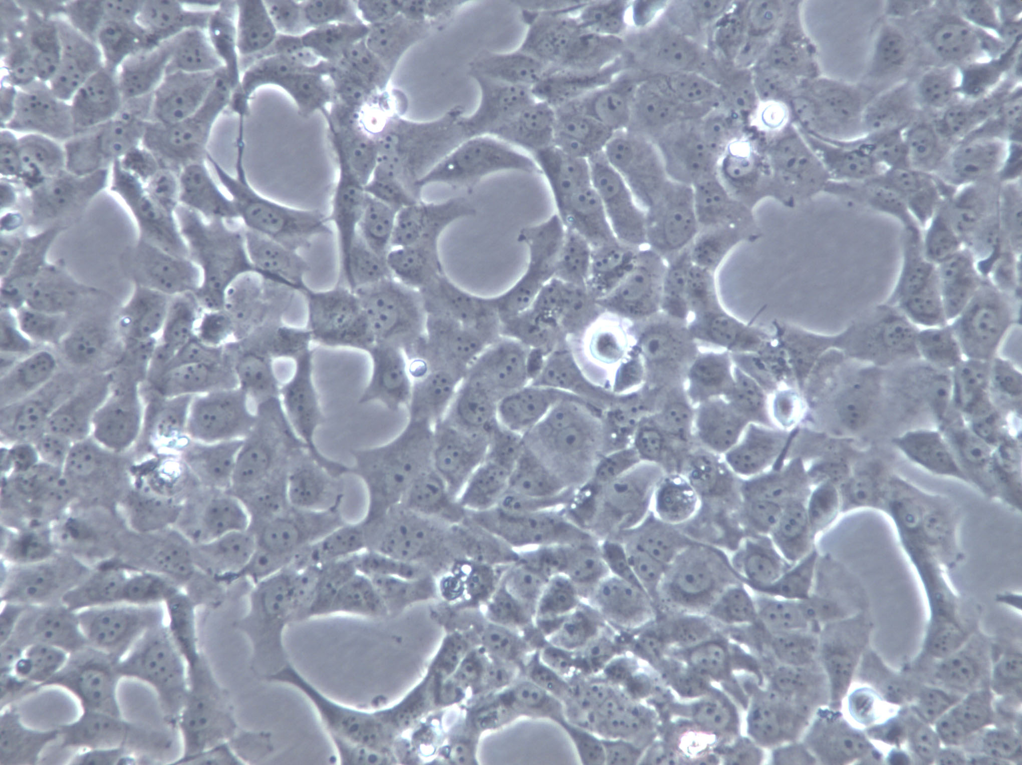 KYSE-520 Cells(赠送Str鉴定报告)|人食管鳞癌细胞