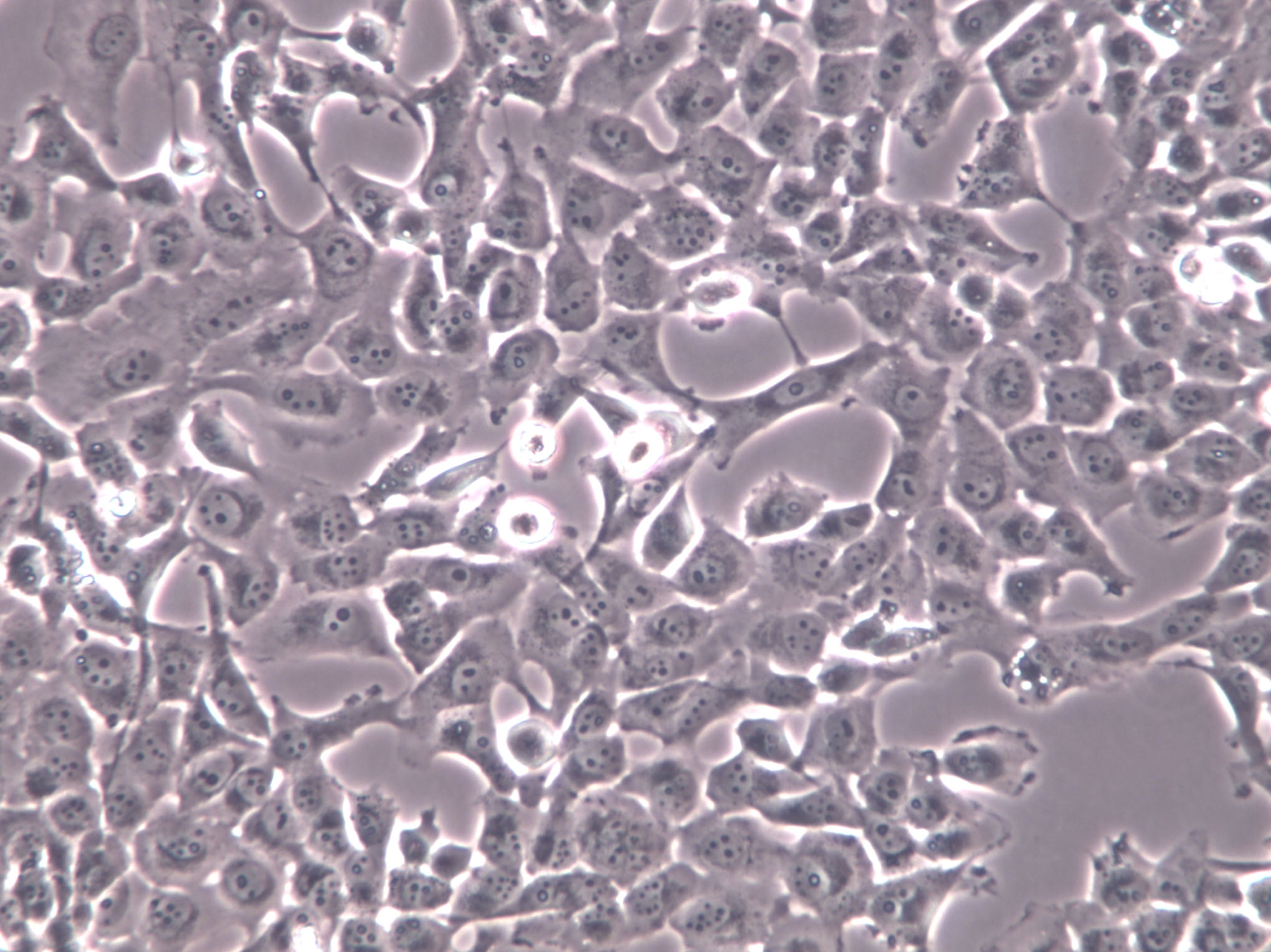 COLO 16 Cells(赠送Str鉴定报告)|人皮肤鳞癌细胞