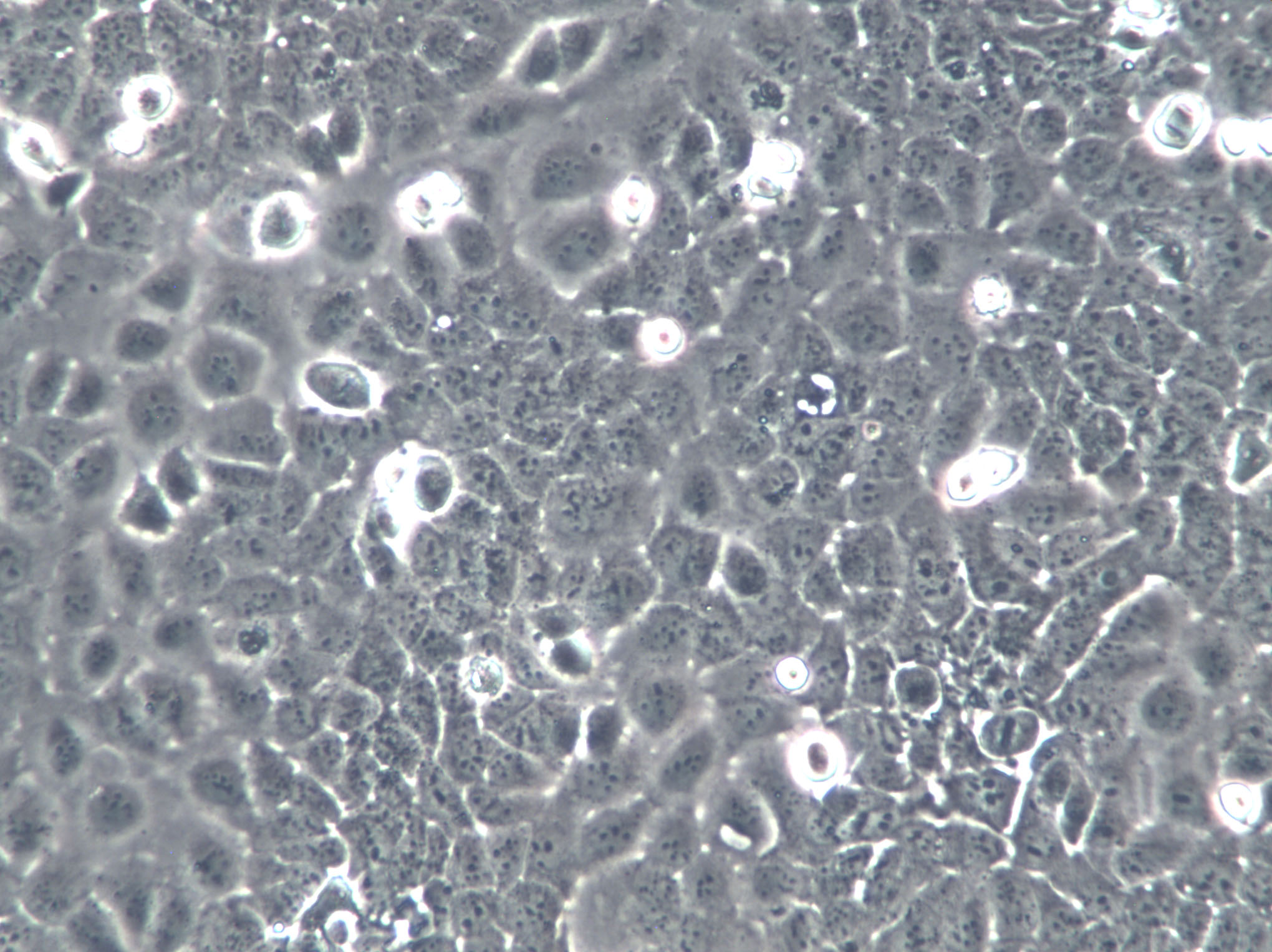 SK-GT-2 Cells(赠送Str鉴定报告)|人胃癌细胞