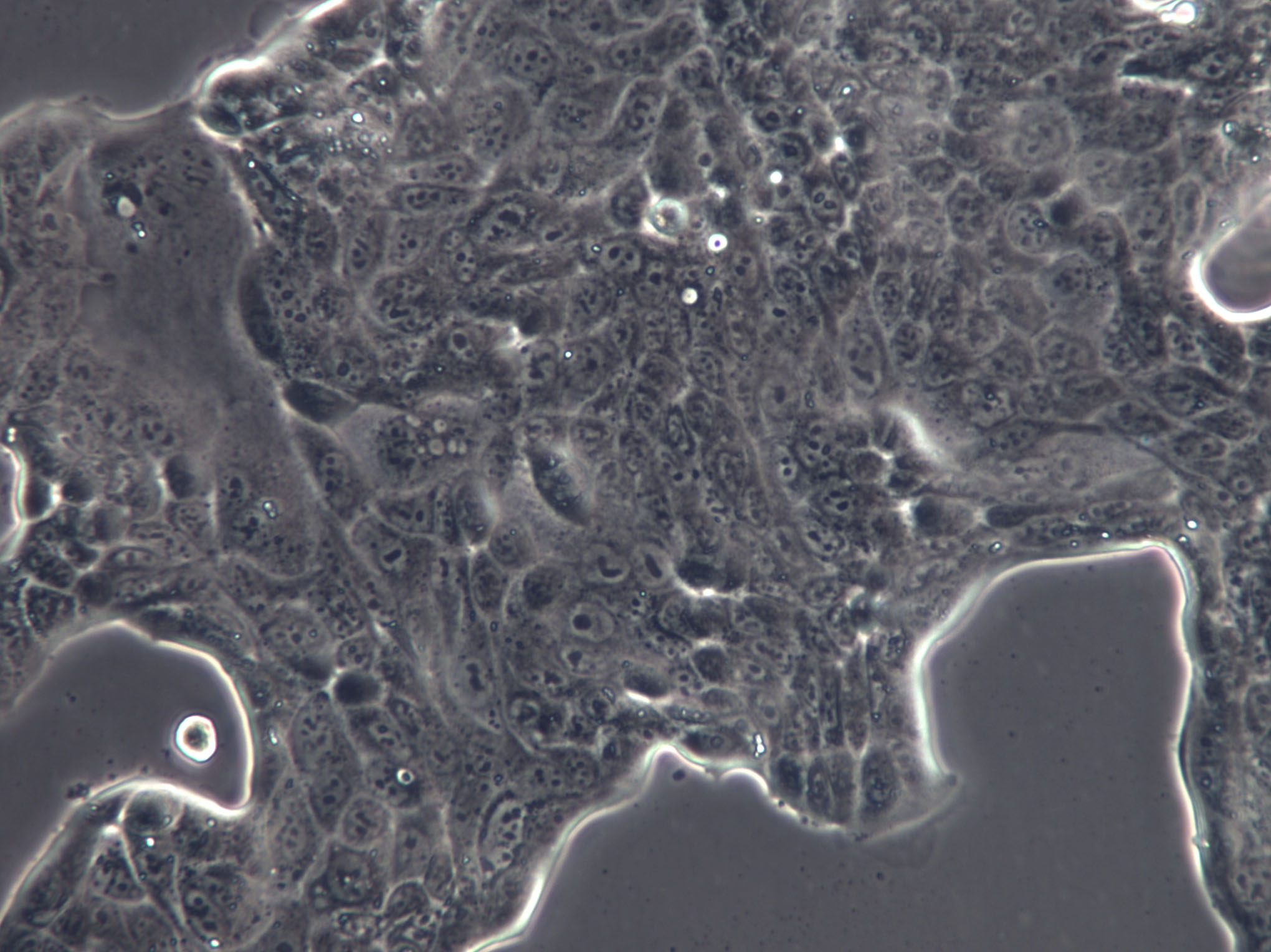 M109 Cells(赠送Str鉴定报告)|小鼠肺癌细胞