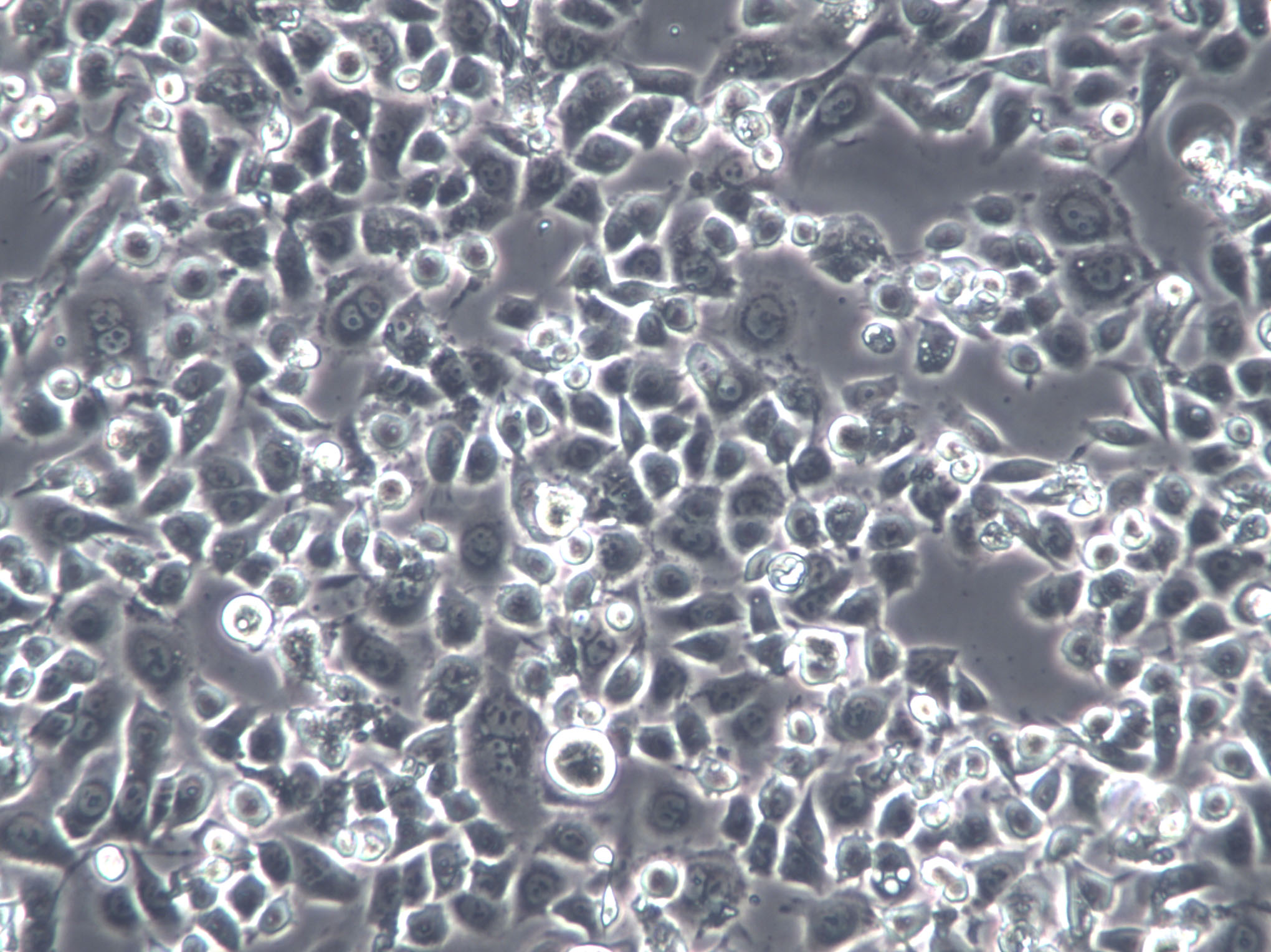 SK-RC-52 Cells(赠送Str鉴定报告)|人肾癌细胞