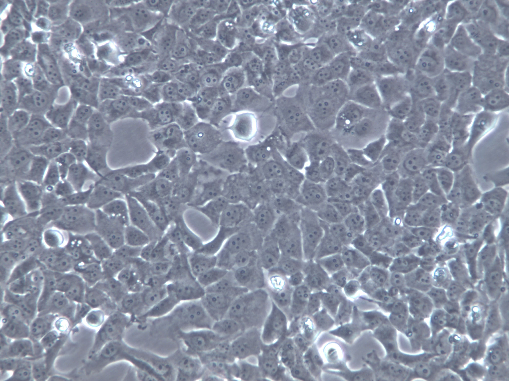 MB49 Cells(赠送Str鉴定报告)|小鼠膀胱癌细胞