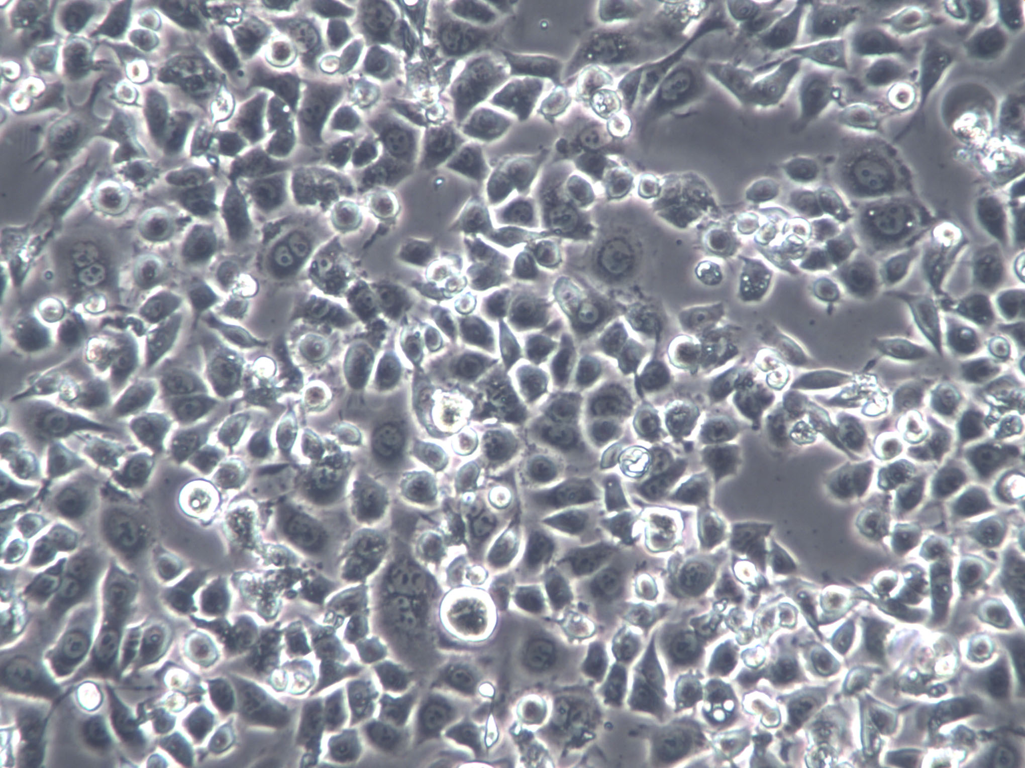 A-427 Cells(赠送Str鉴定报告)|人肺腺癌细胞