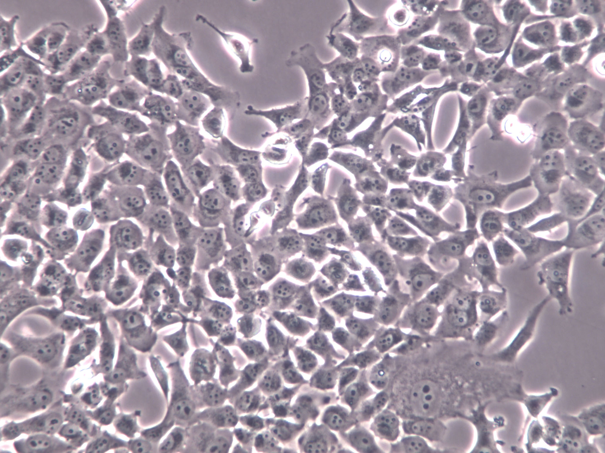 Nthy-ori 3-1 Cells|人甲状腺正常克隆细胞