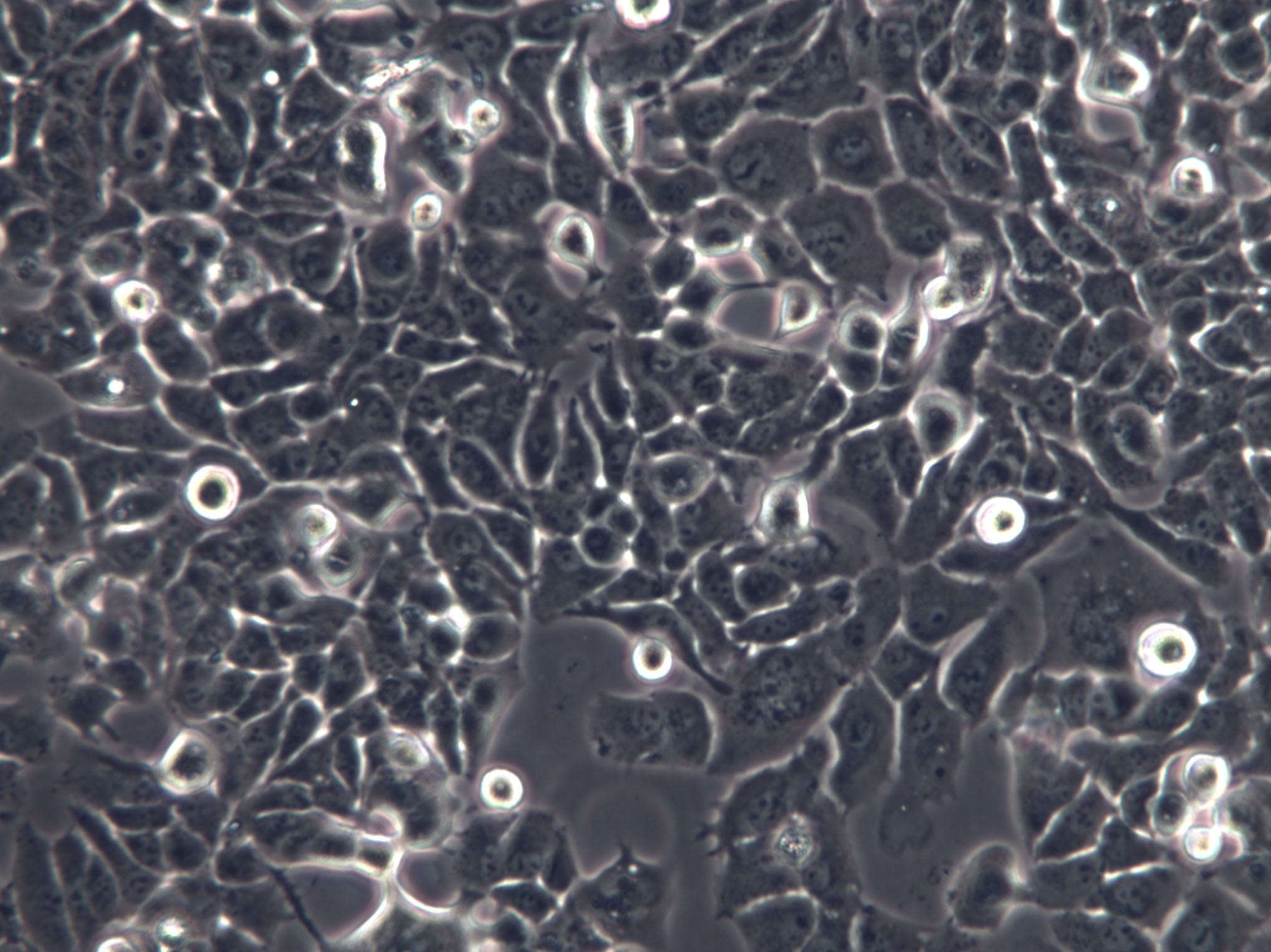 Hca-F Cells(赠送Str鉴定报告)|小鼠肝癌细胞