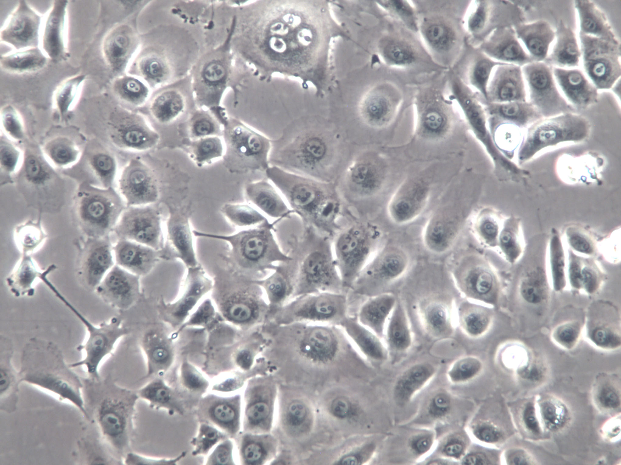 HNE-1 Cells(赠送Str鉴定报告)|人鼻咽癌细胞