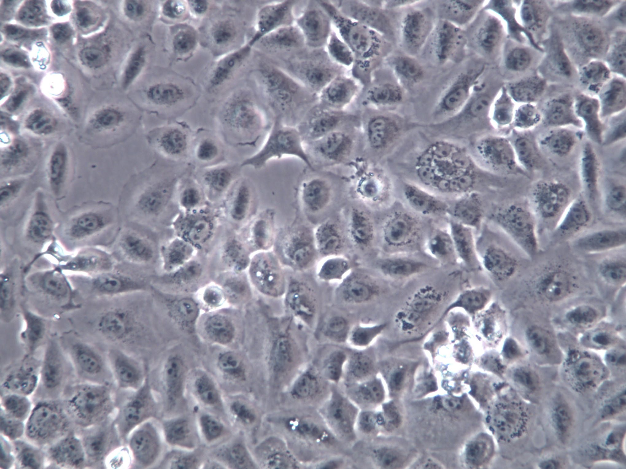 EAC-E2G8 Cells(赠送Str鉴定报告)|小鼠腹水瘤细胞