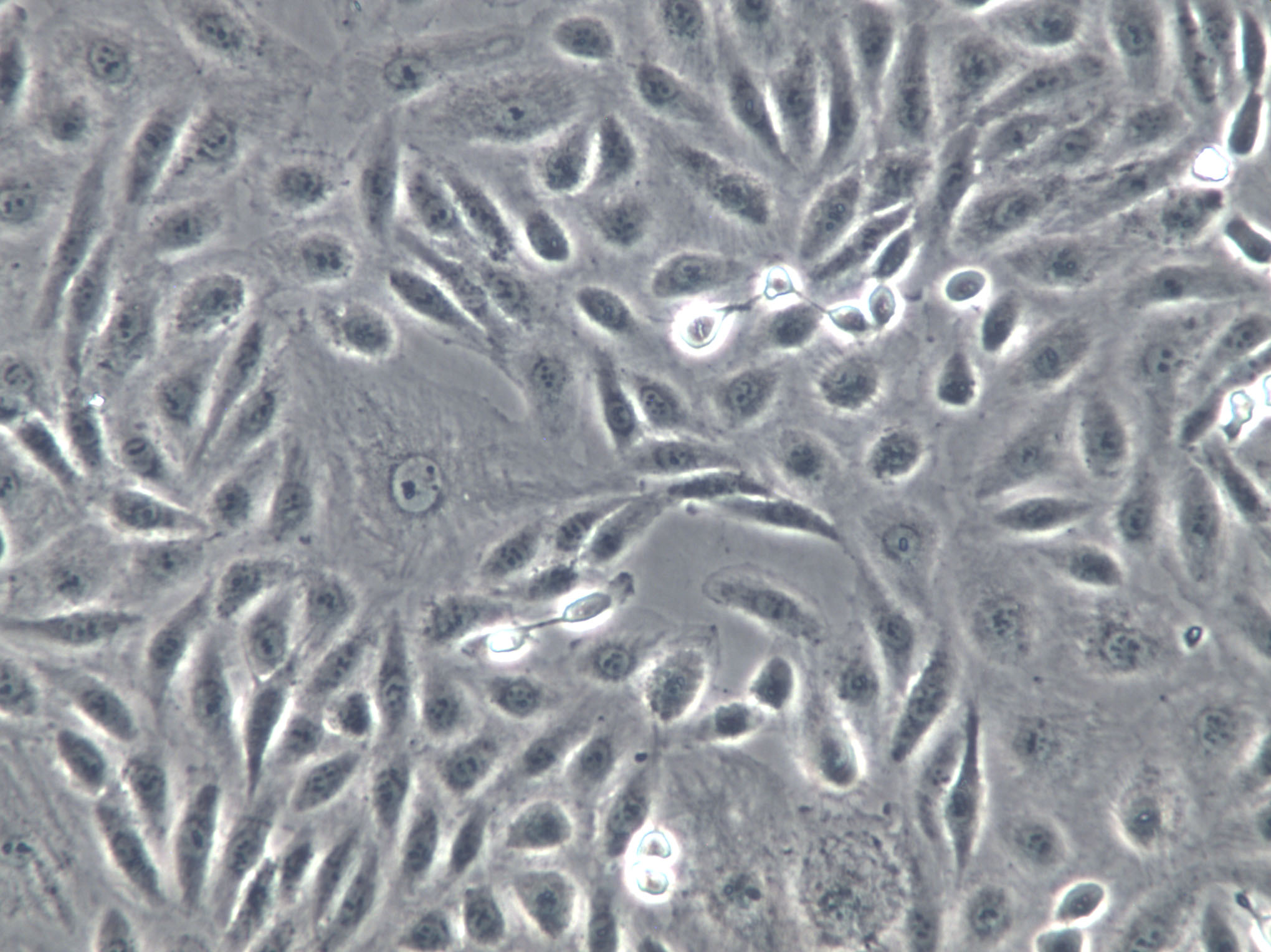 MV3 Cells(赠送Str鉴定报告)|人黑色素瘤细胞