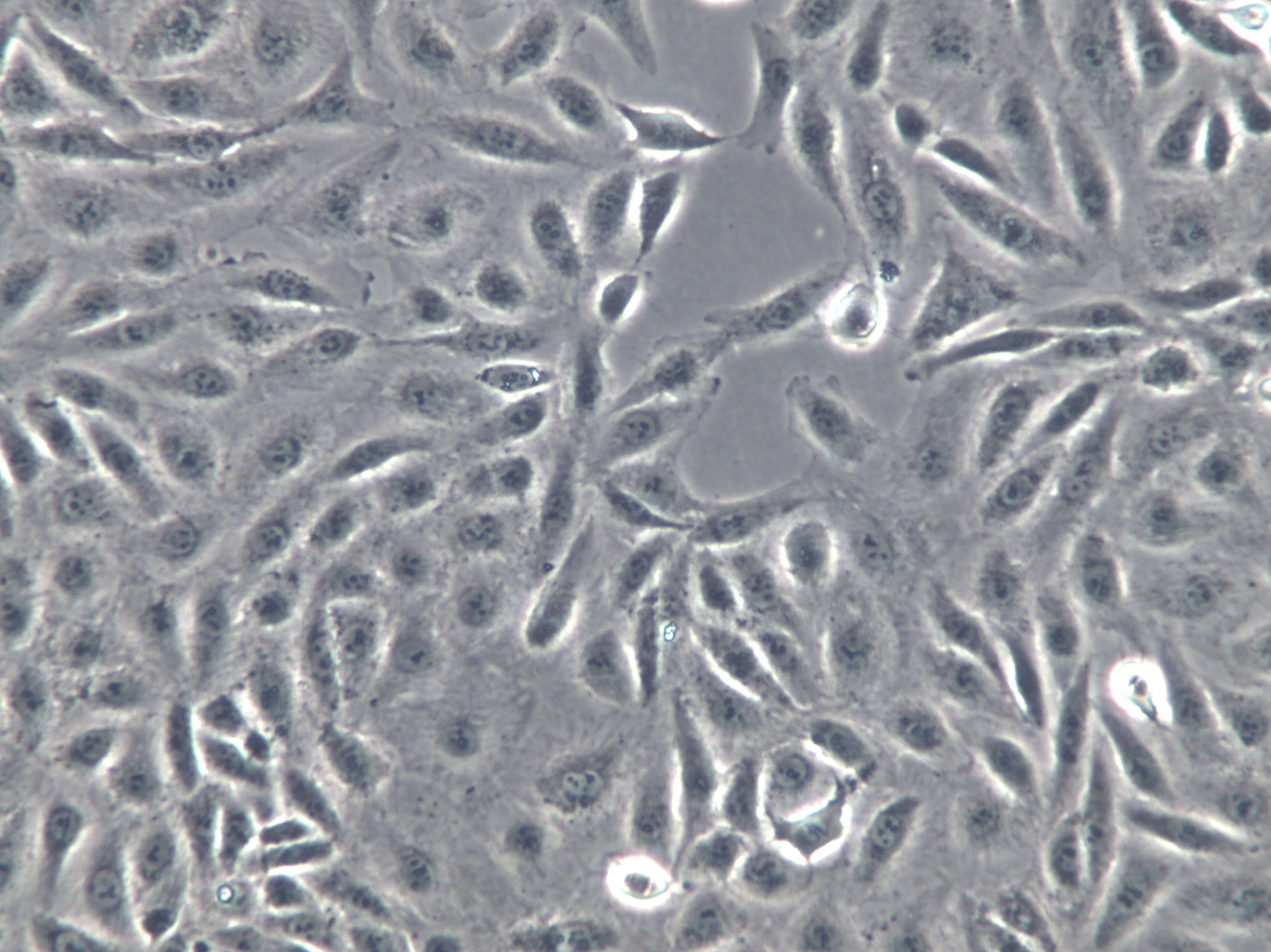 LMH Cells(赠送Str鉴定报告)|鸡肝癌细胞