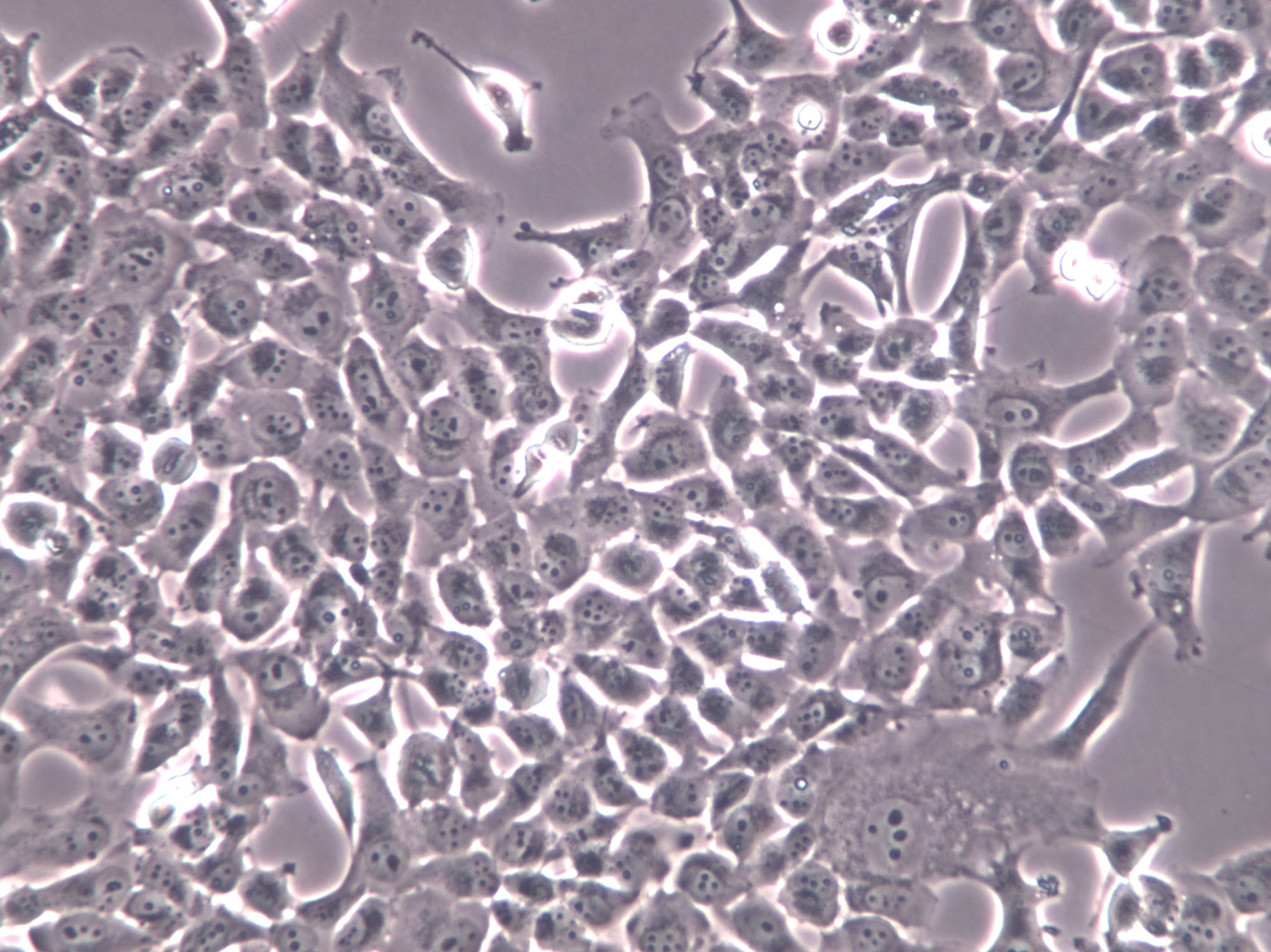 KYSE-180 Cells(赠送Str鉴定报告)|人食管鳞癌细胞