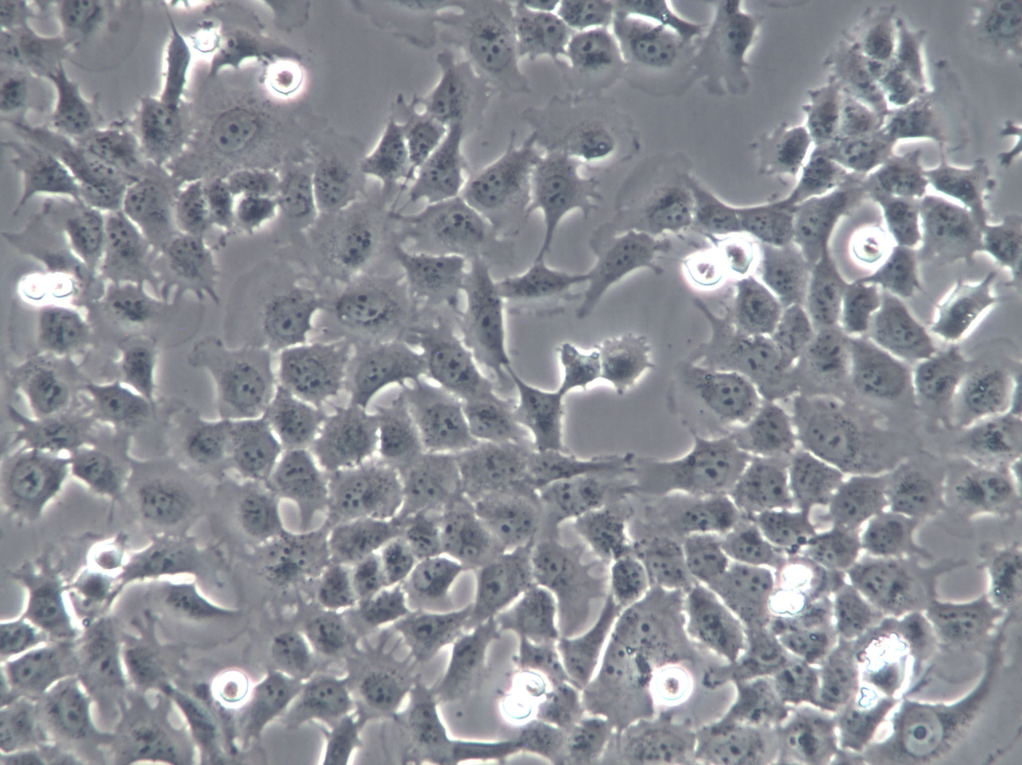 HCCLM6 Cells(赠送Str鉴定报告)|人肝癌细胞