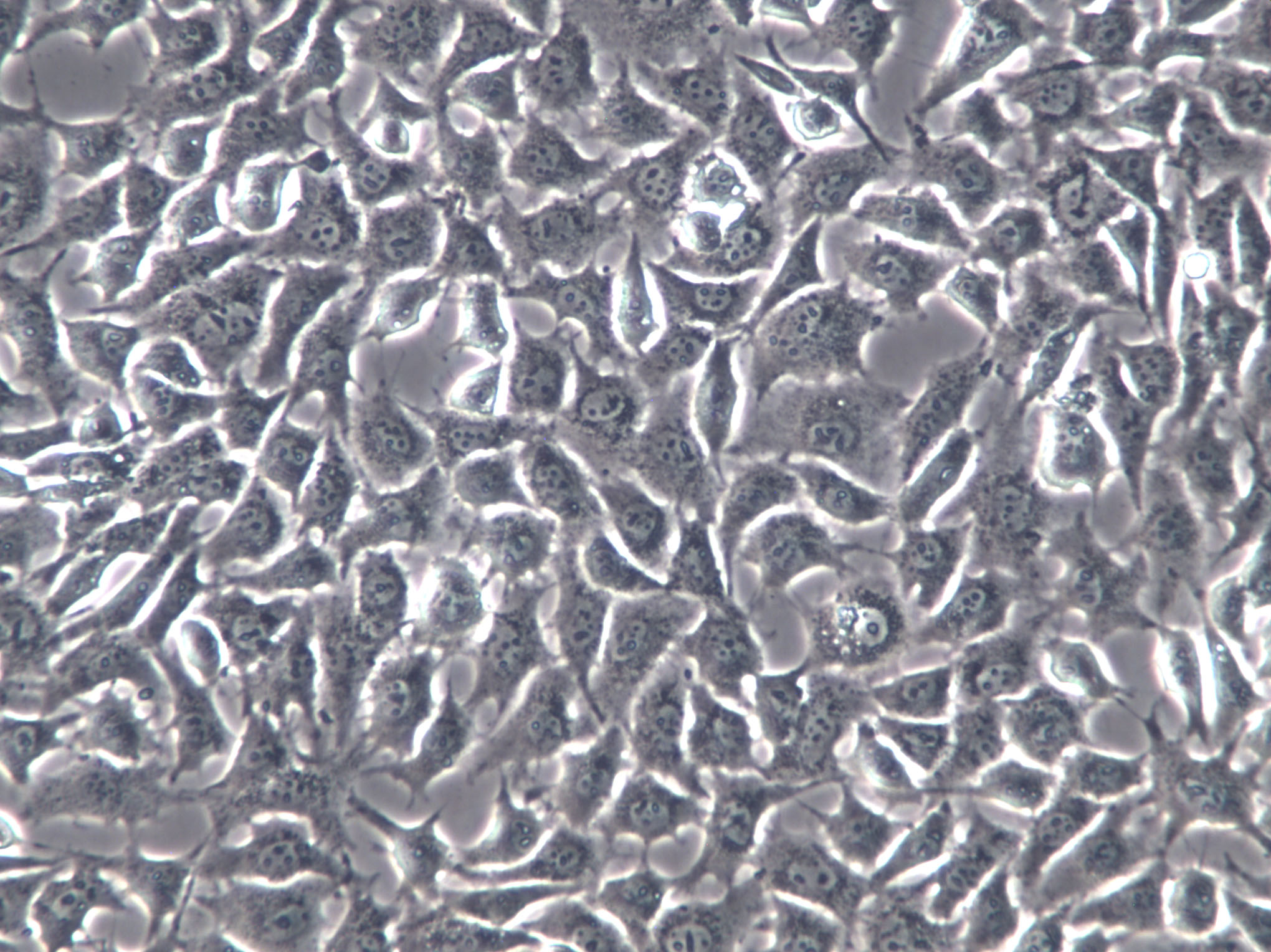 C-28/I2 Cells(赠送Str鉴定报告)|人正常软骨细胞