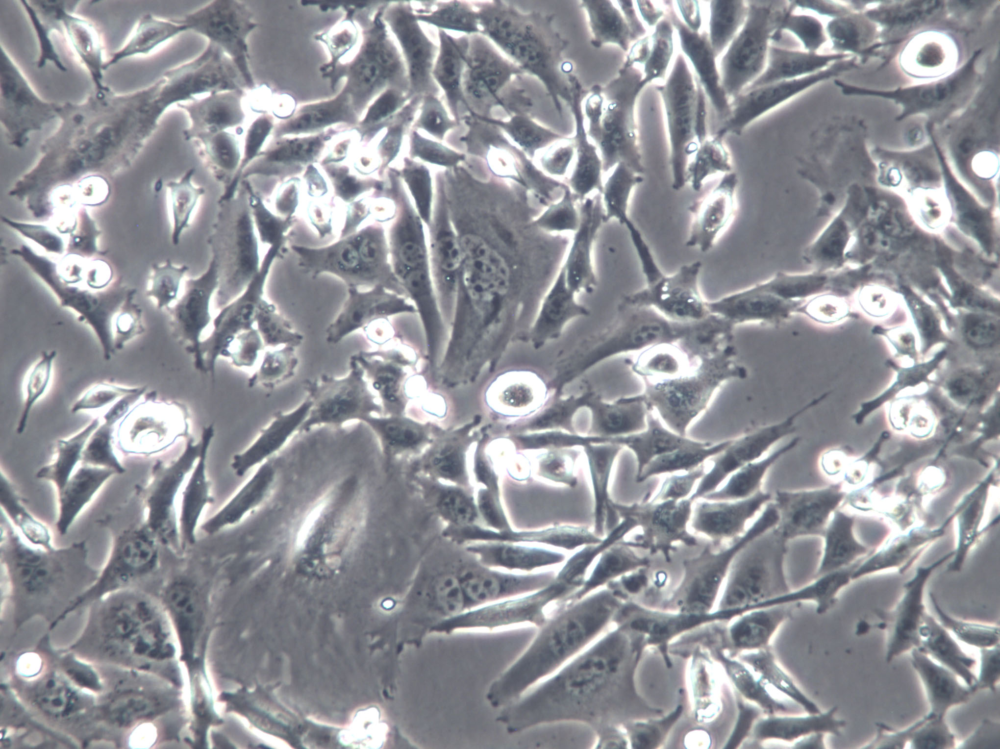 BAEC Cells(赠送Str鉴定报告)|牛主动脉内皮细胞