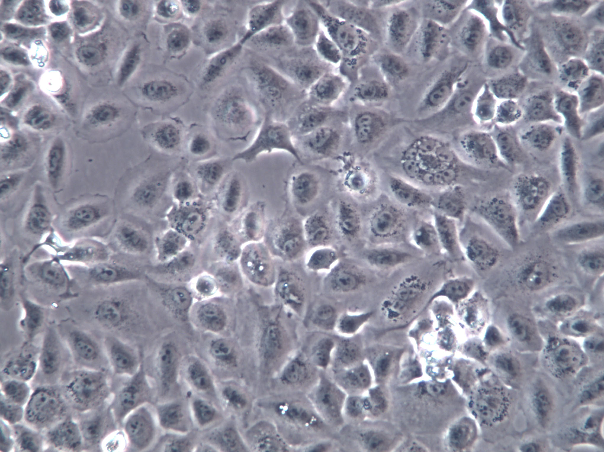 TE 671 Cells(赠送Str鉴定报告)|人胚胎横纹肌瘤细胞