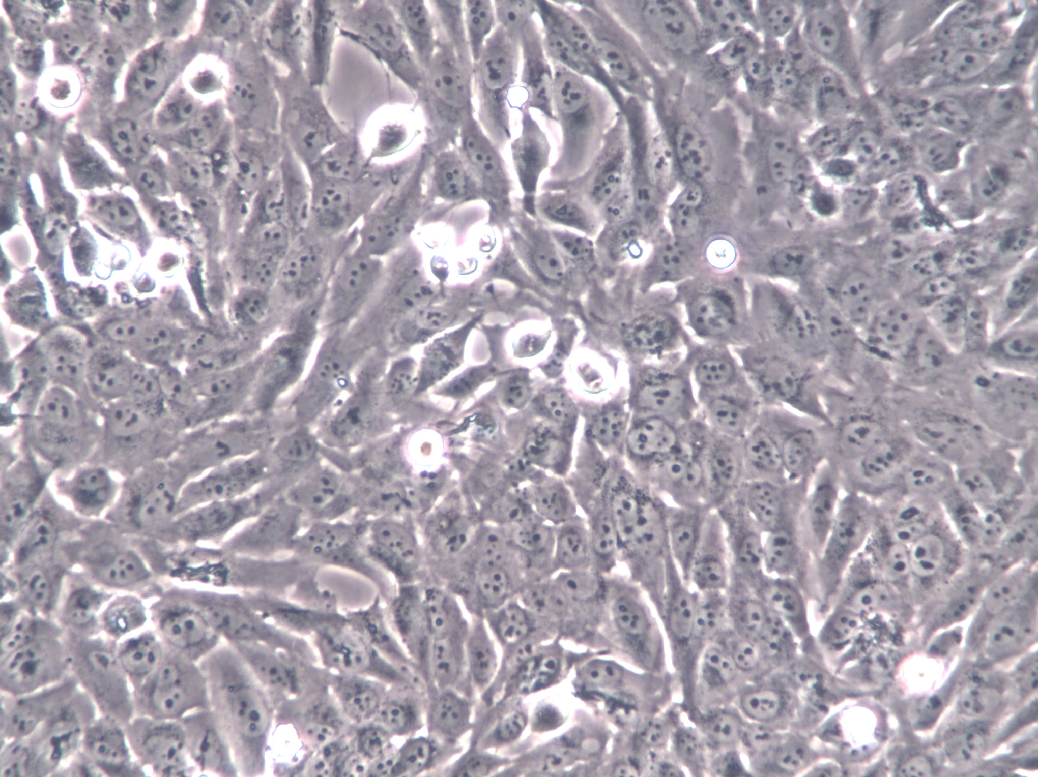 Hs 578Bst Cells(赠送Str鉴定报告)|人正常乳腺细胞