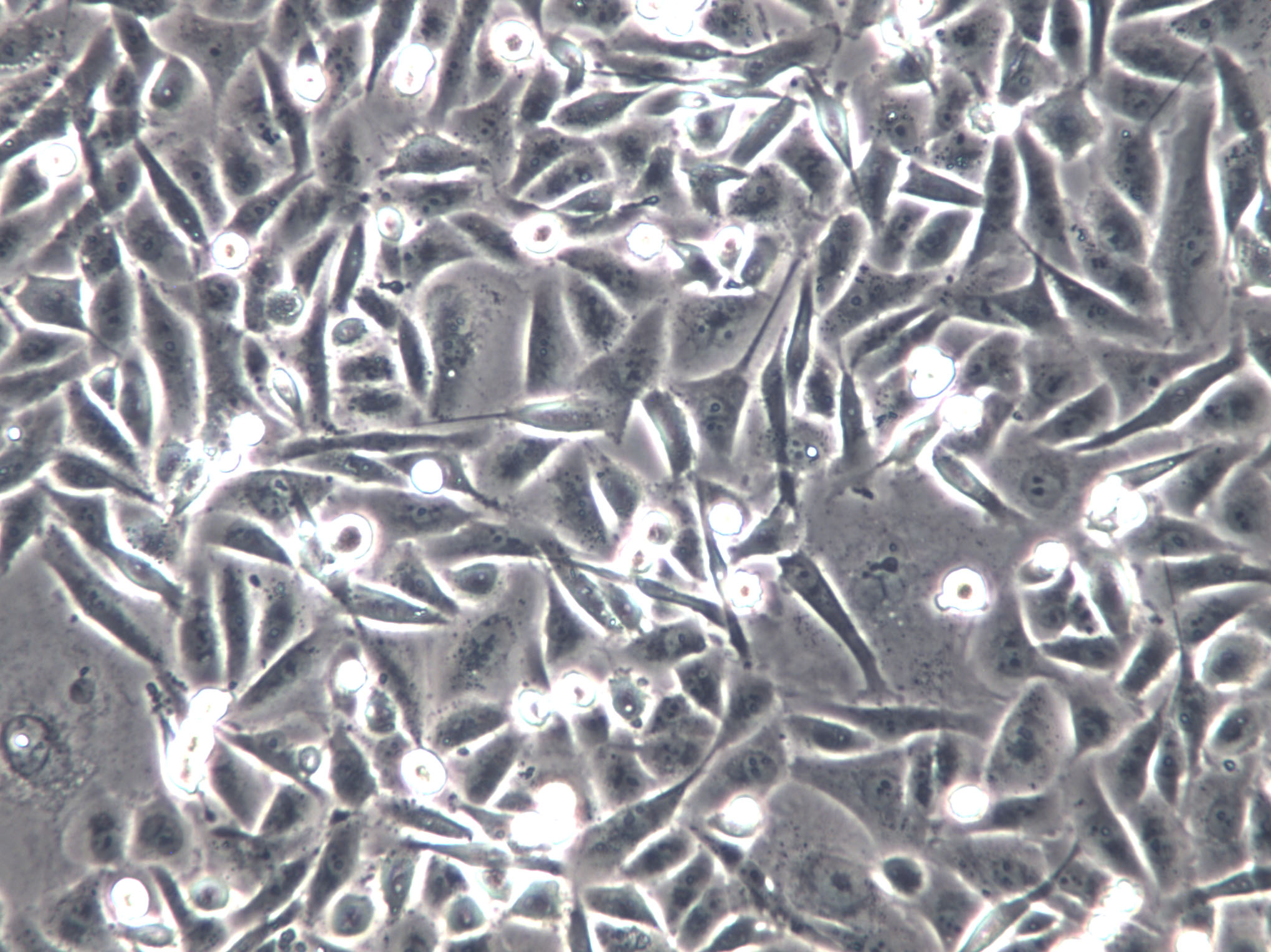 T-HEECs Cells(赠送Str鉴定报告)|人正常食管上皮细胞